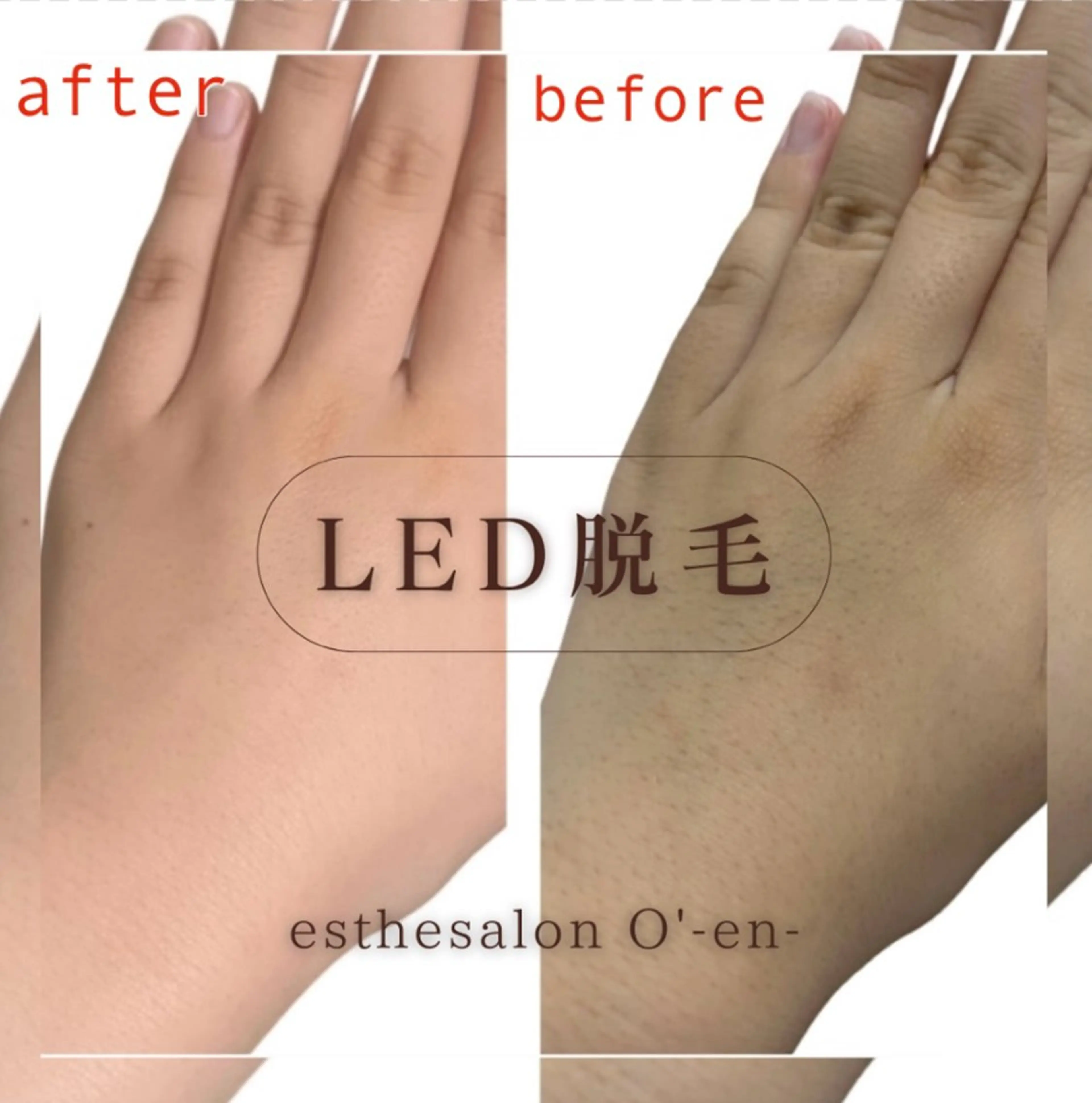 esthesalon O'-en-のエステ・リラクイメージ