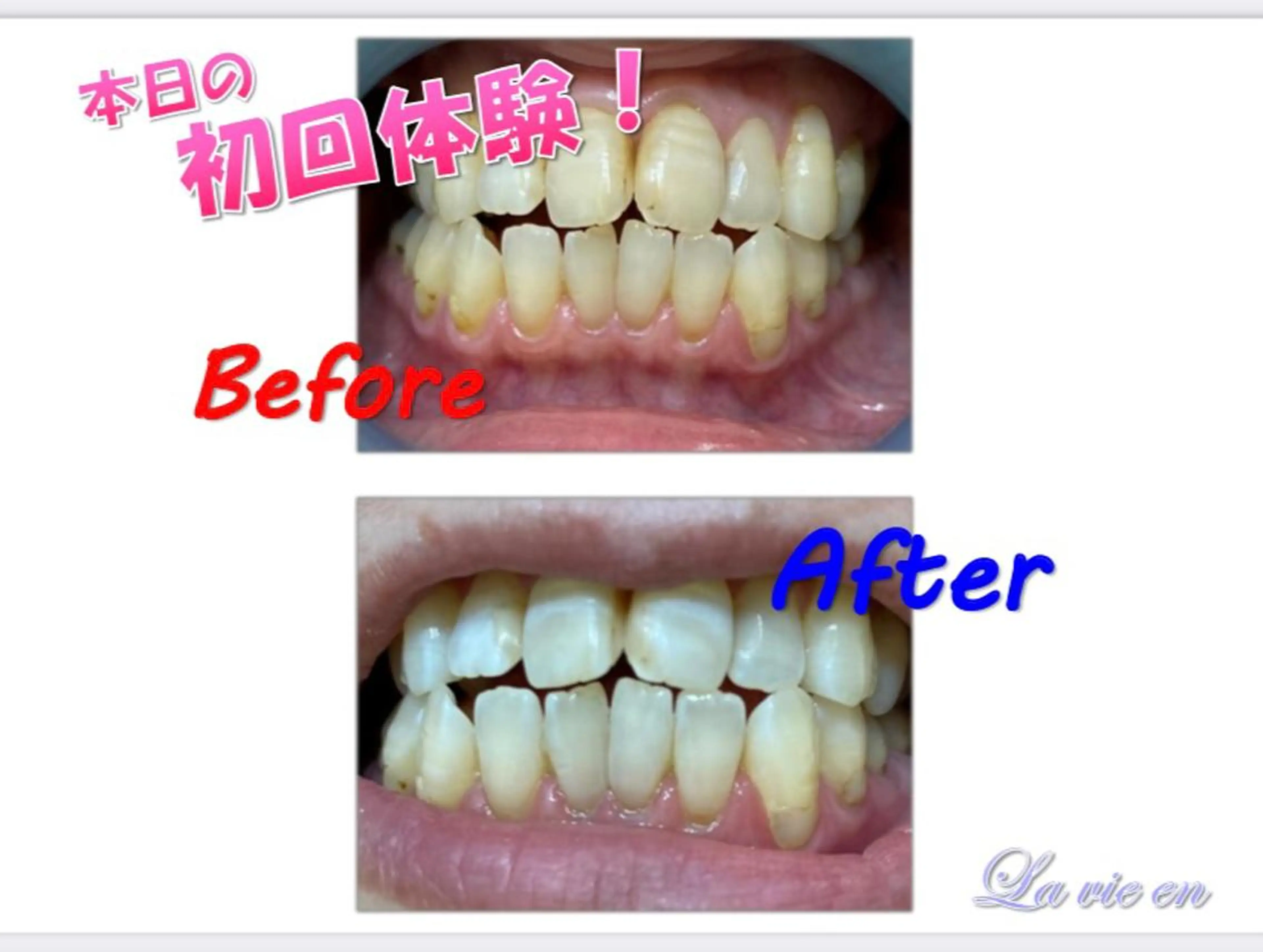 その他 ホワイトニングサロン La vie enのその他イメージ
