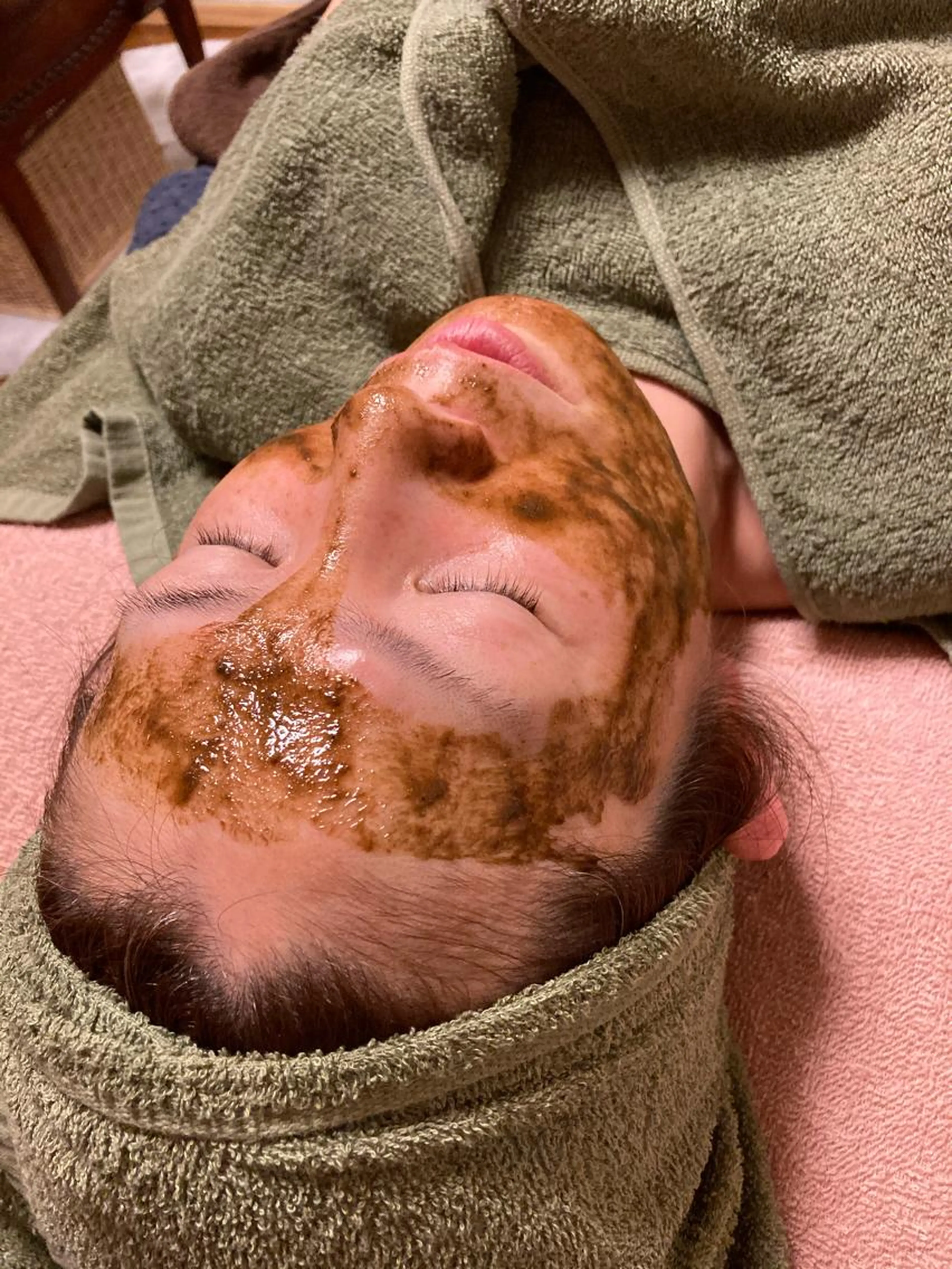 【ニキビ・シミ・シワ・アトピー肌にも⭐︎肌質改善】ハーブピーリングの写真