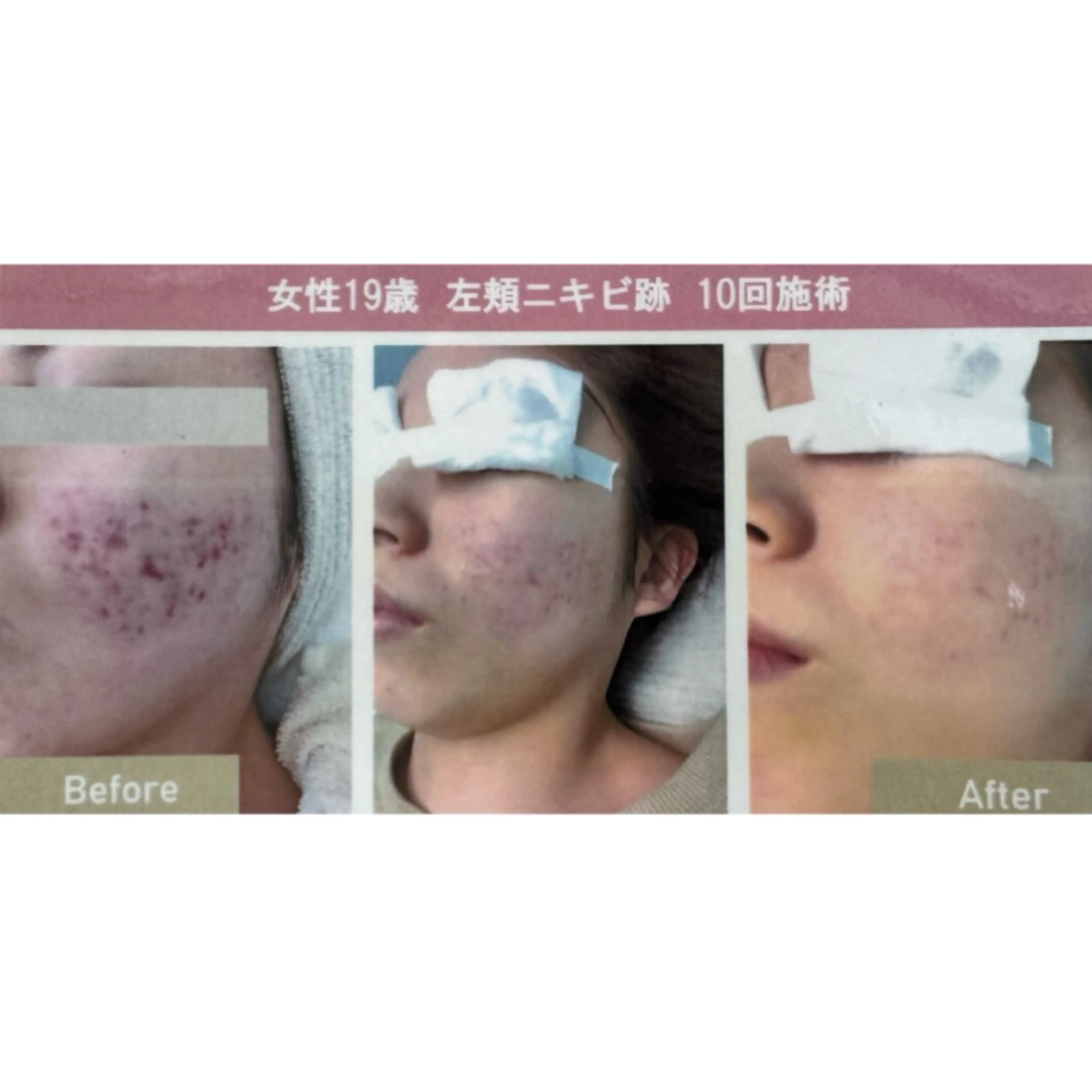 エステ 🤍SÉALIE⟡. ｼｱﾘｰ脱毛サロンのエステ・リラクイメージ