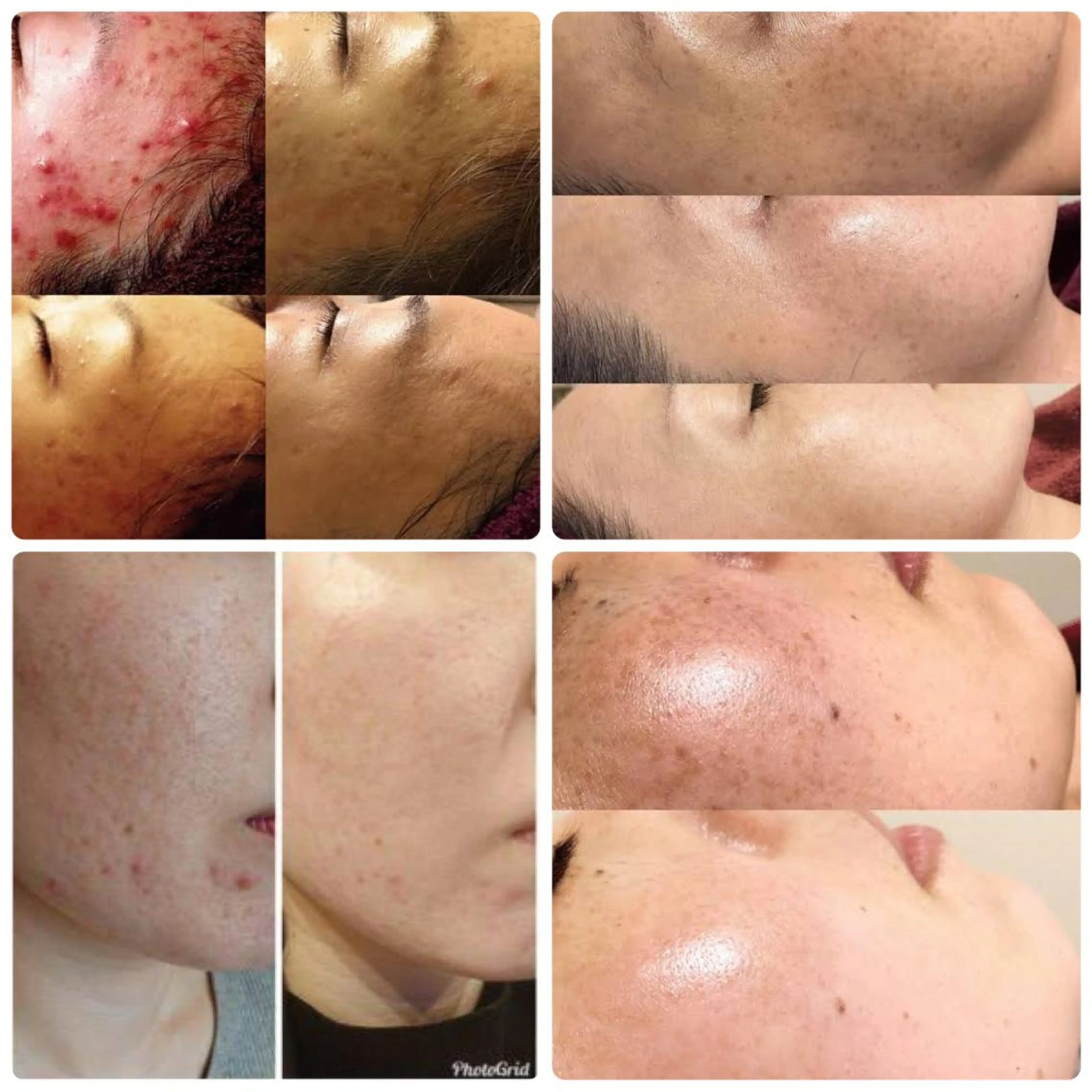 ネイル 肌管理&nail Salon  Duxのエステ・リラクイメージ