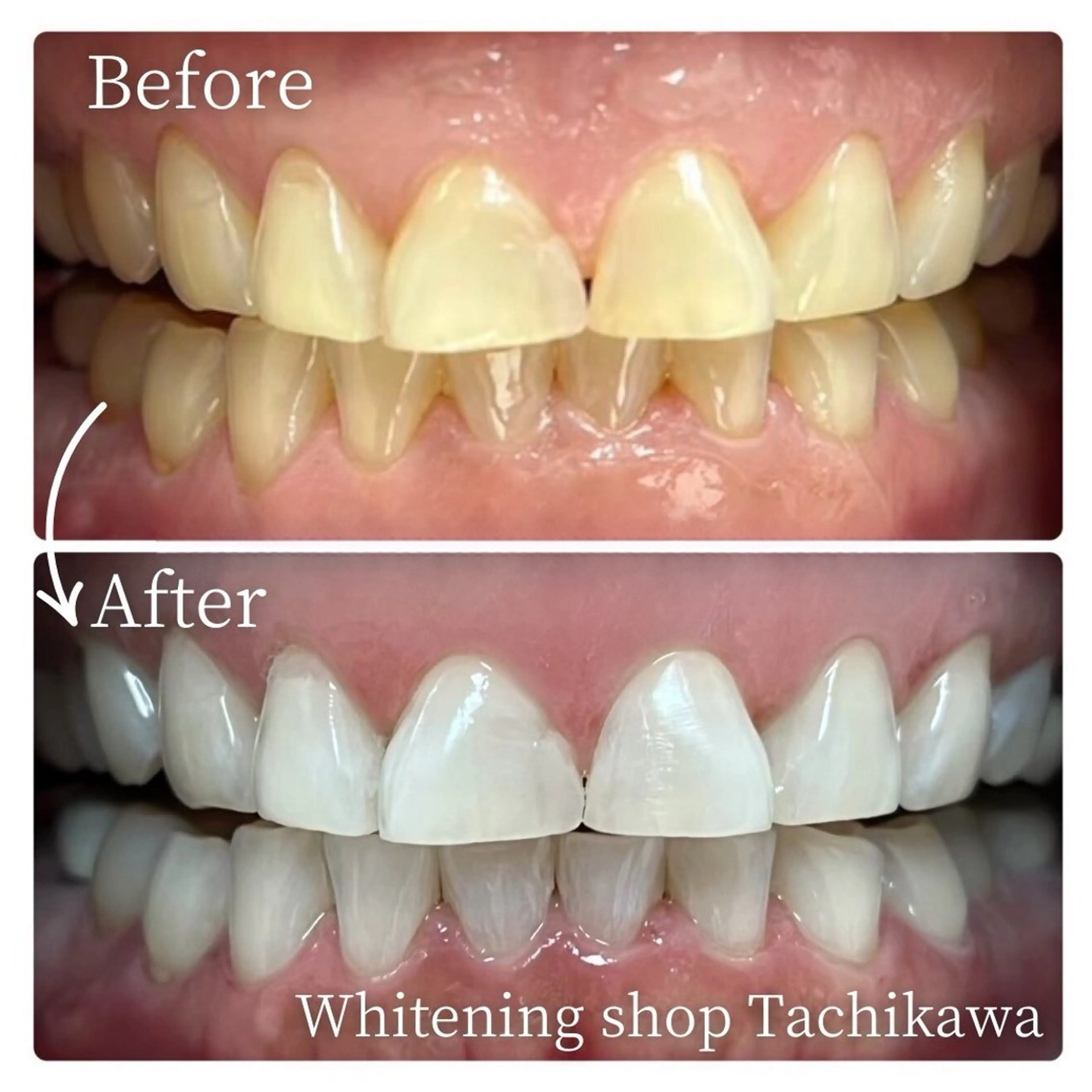 セルフ　ホワイト ニングショップ立川のその他イメージ