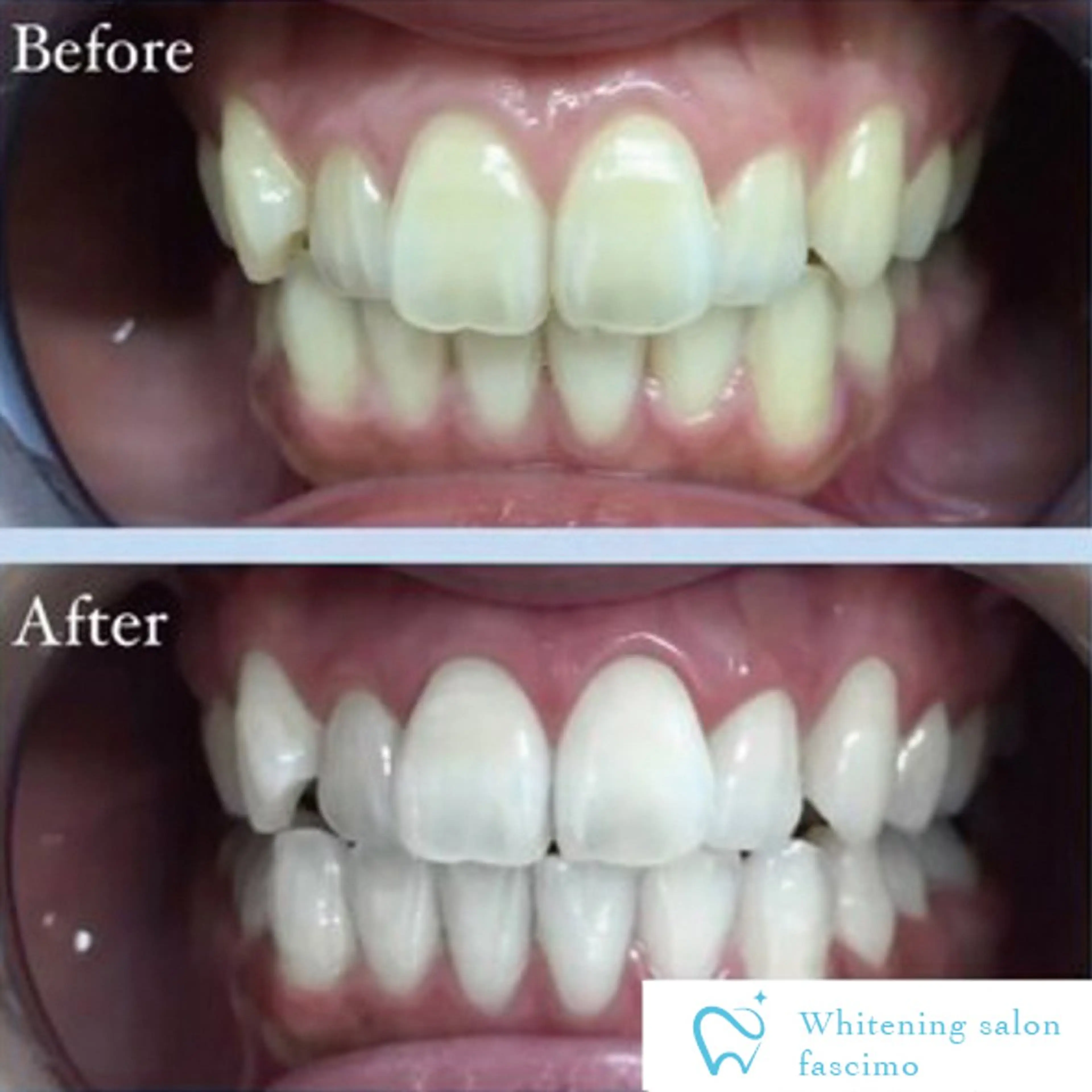 その他 ホワイトニングサロン fascimo新座店のその他イメージ