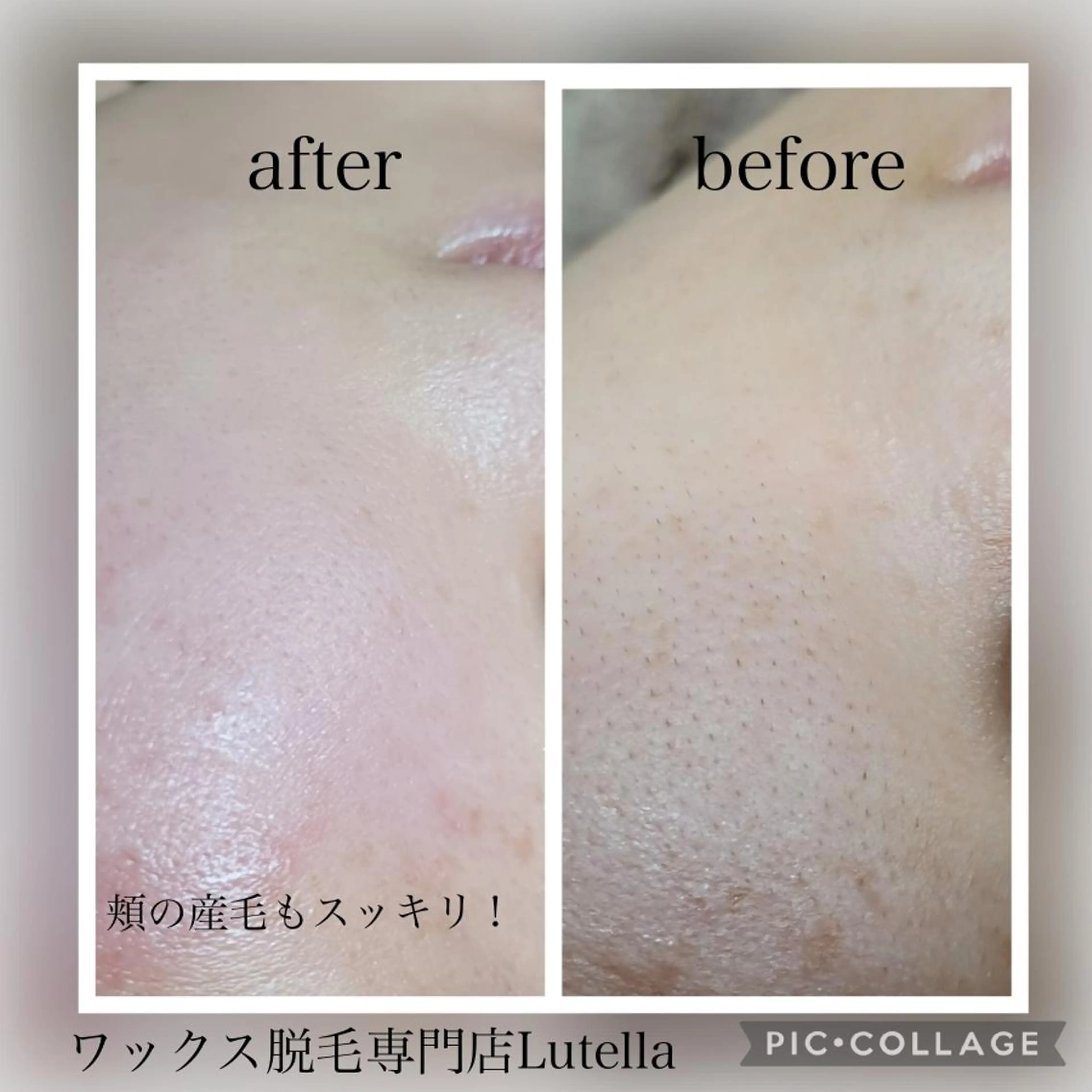 Lutella所属・ワックス脱毛専門店 Lutellaのエステ・リラクイメージ