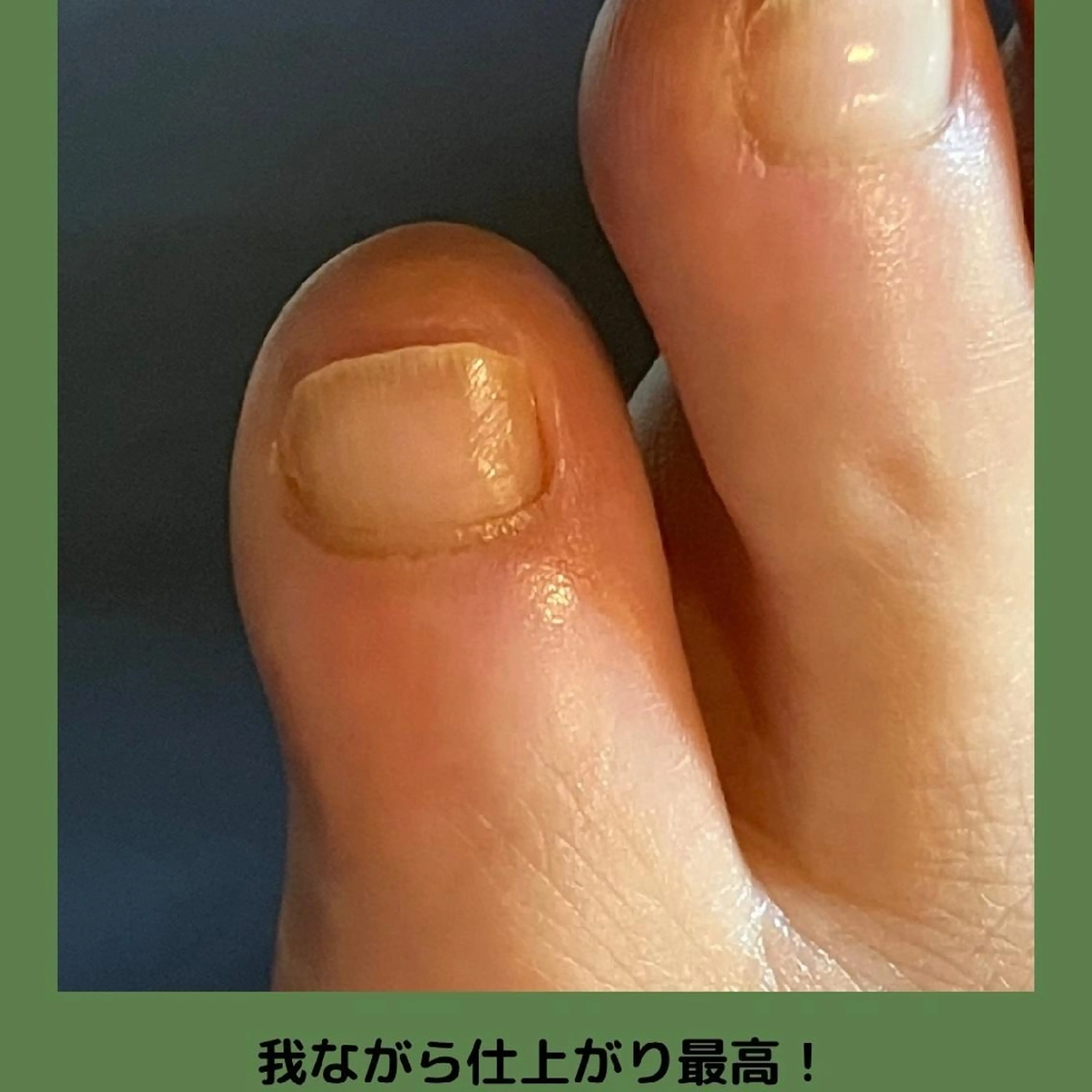 ネイル carenail　 tsugumiのその他イメージ