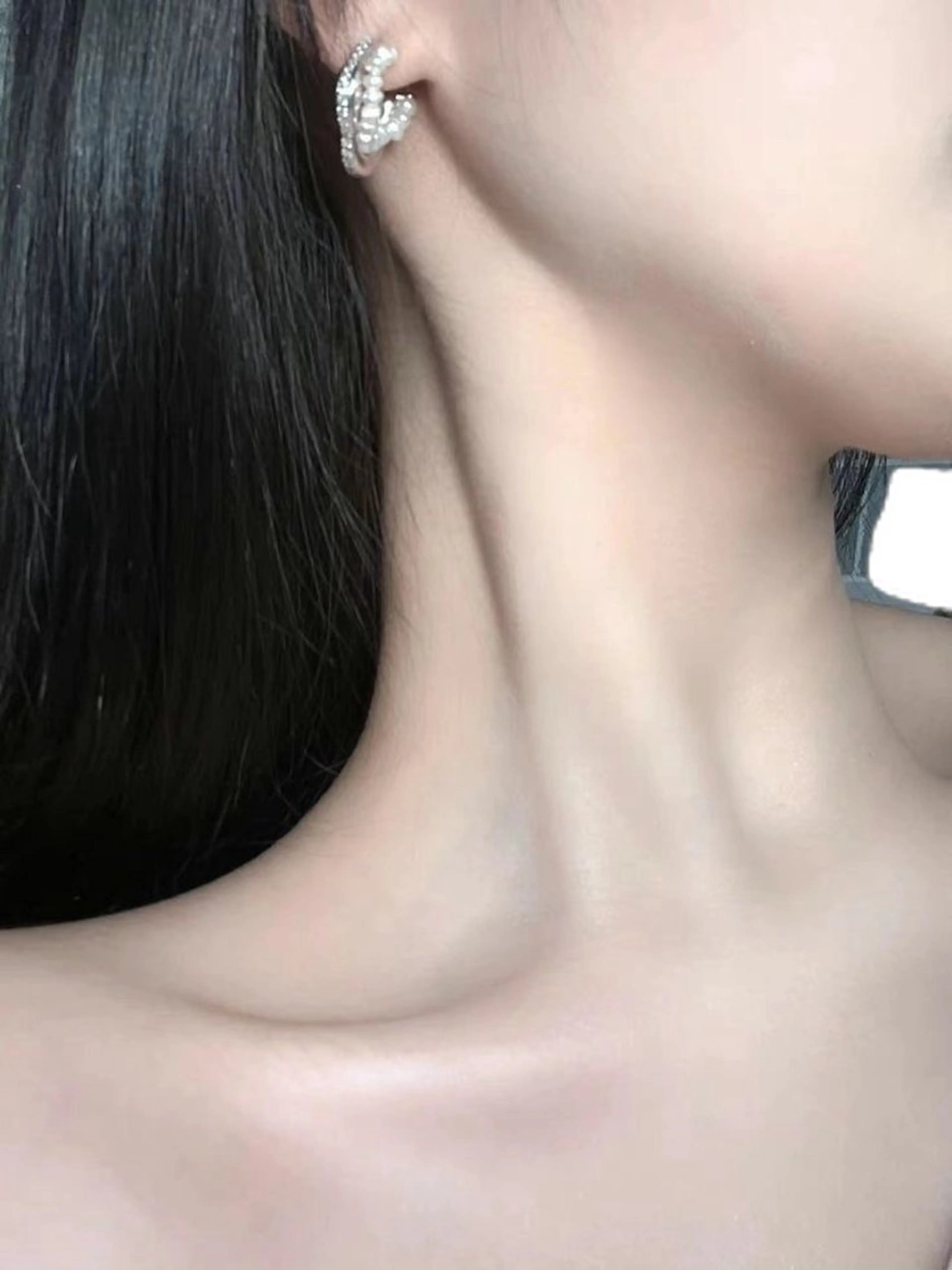 【当日限定】全身脱毛(vio＋顔込み)の写真