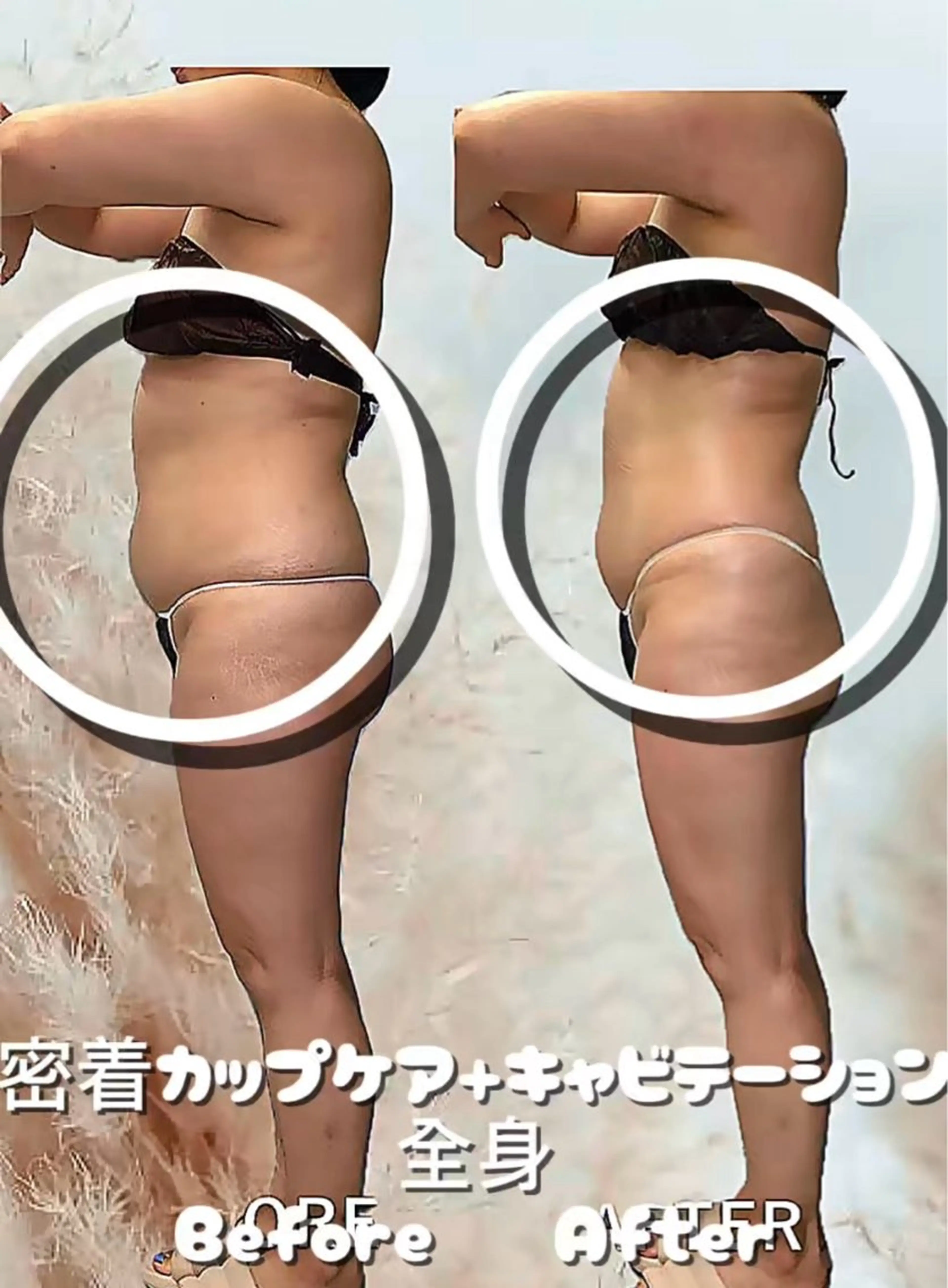 痩身・脱毛・肌管理 Rechica心斎橋のエステ・リラクイメージ