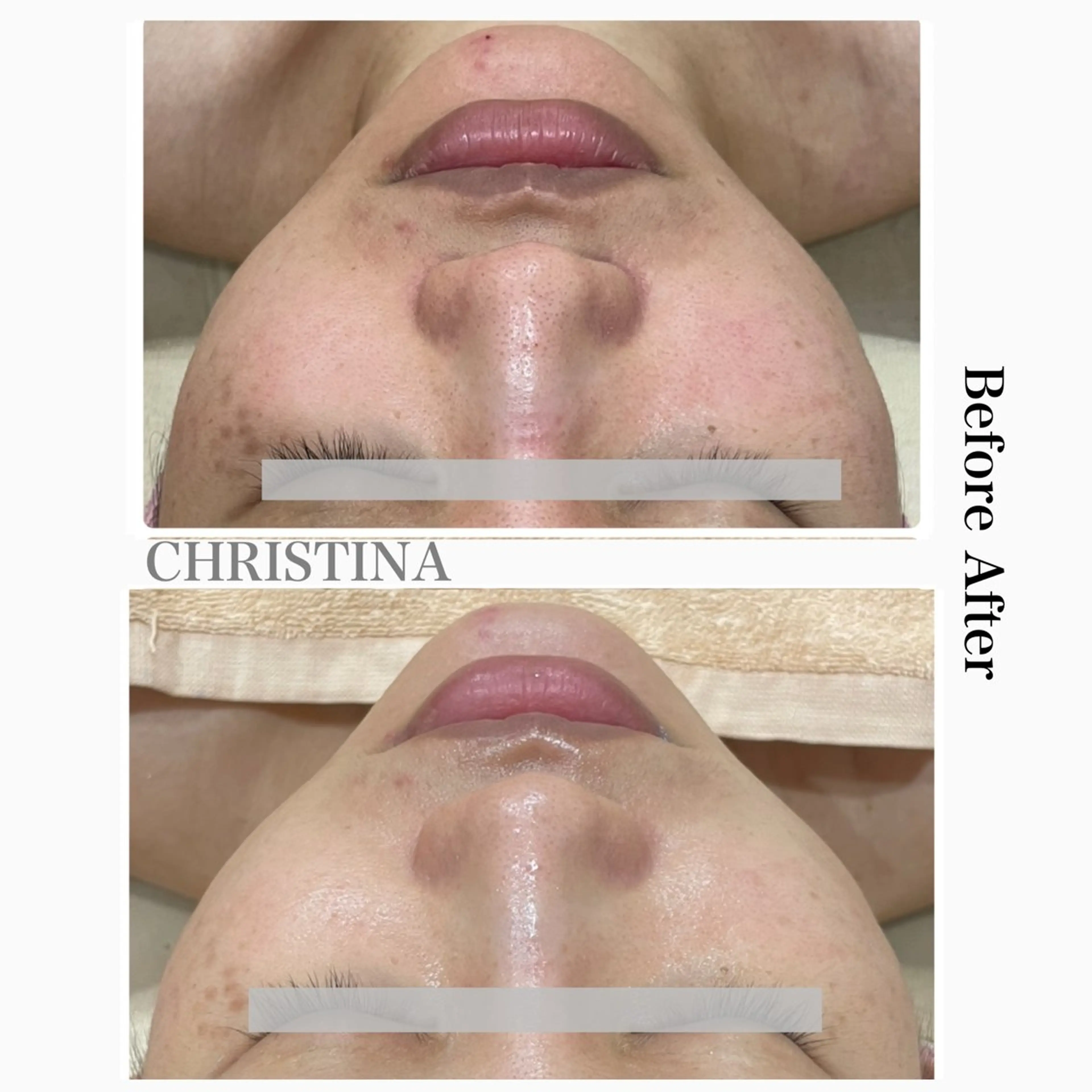 エステ矢野 ジョアアンジェ心斎橋のエステ・リラクイメージ