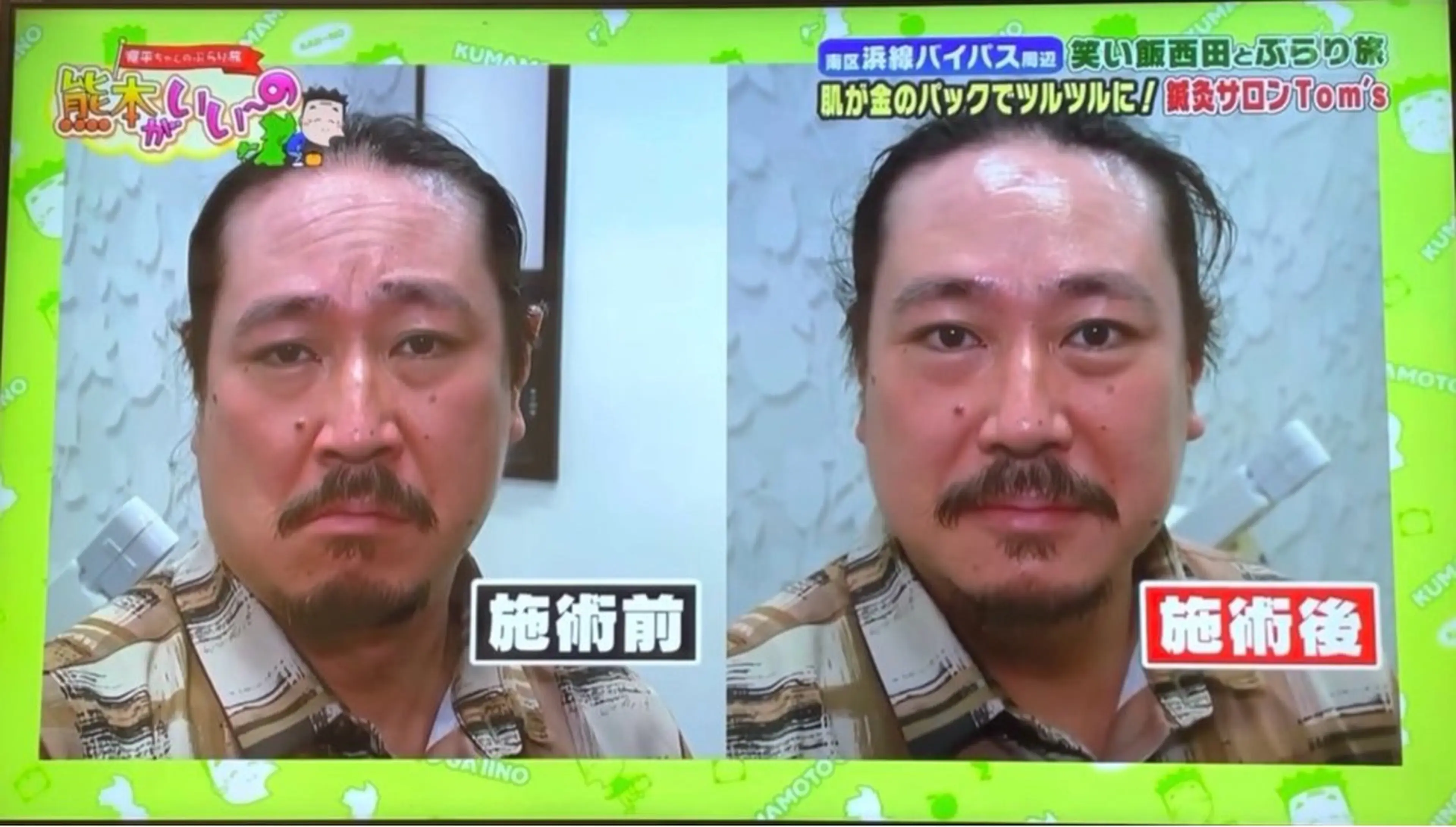 エステ エステサロン トムズのエステ・リラクイメージ