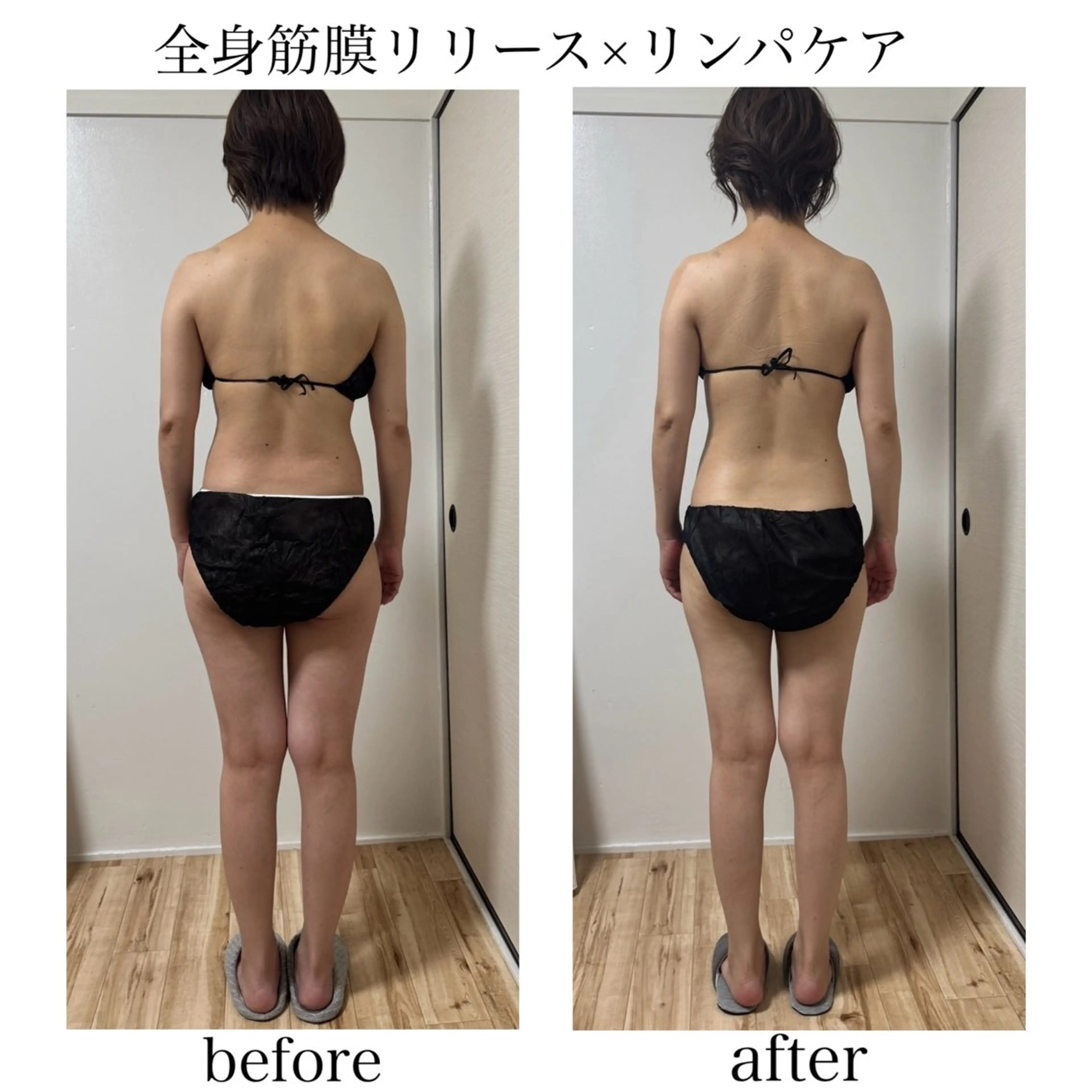 【30日以内にご来店のリピーター様限定15%オフ】筋膜リリース×リンパケアの写真