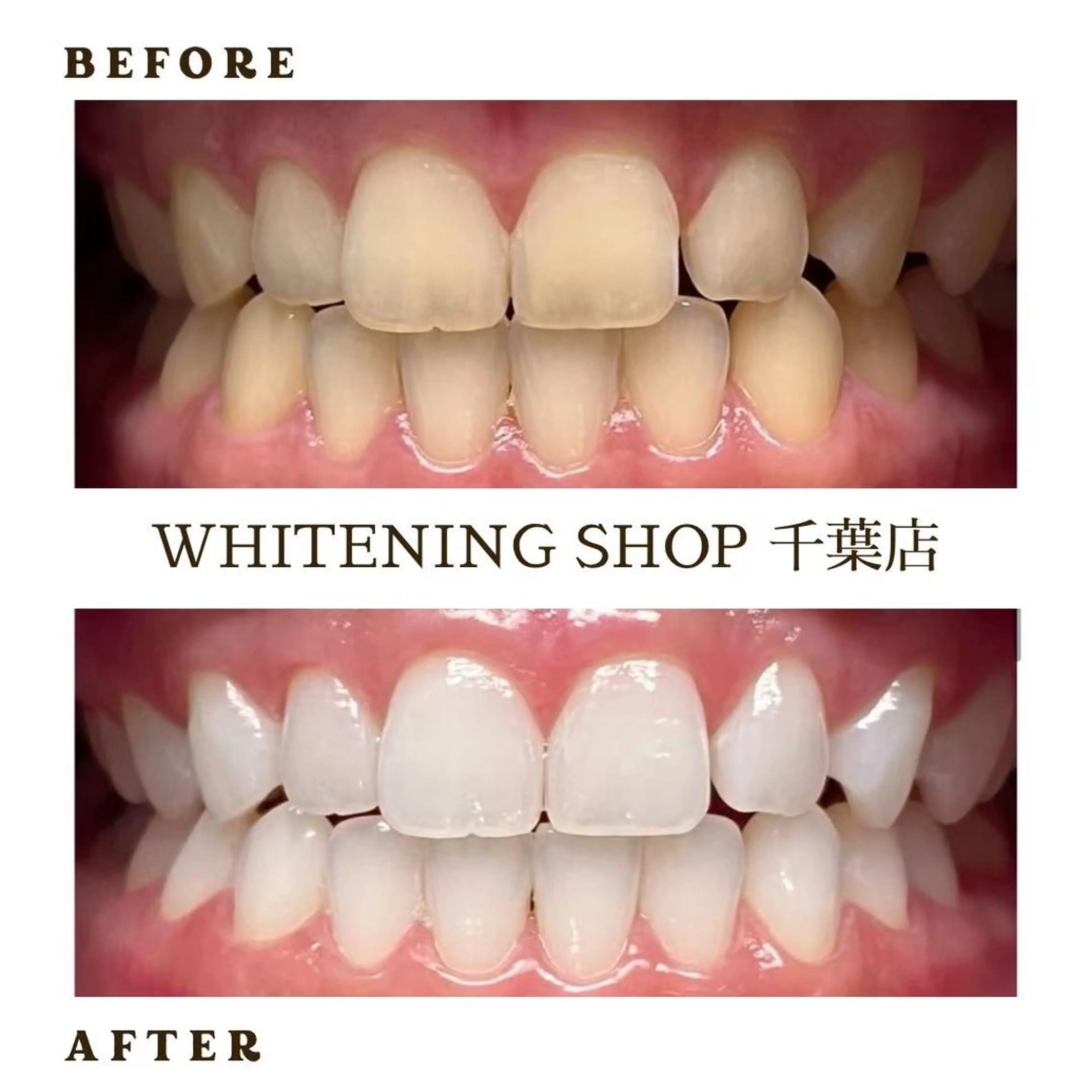 メンズ ホワイトニング ショップ千葉店のその他イメージ