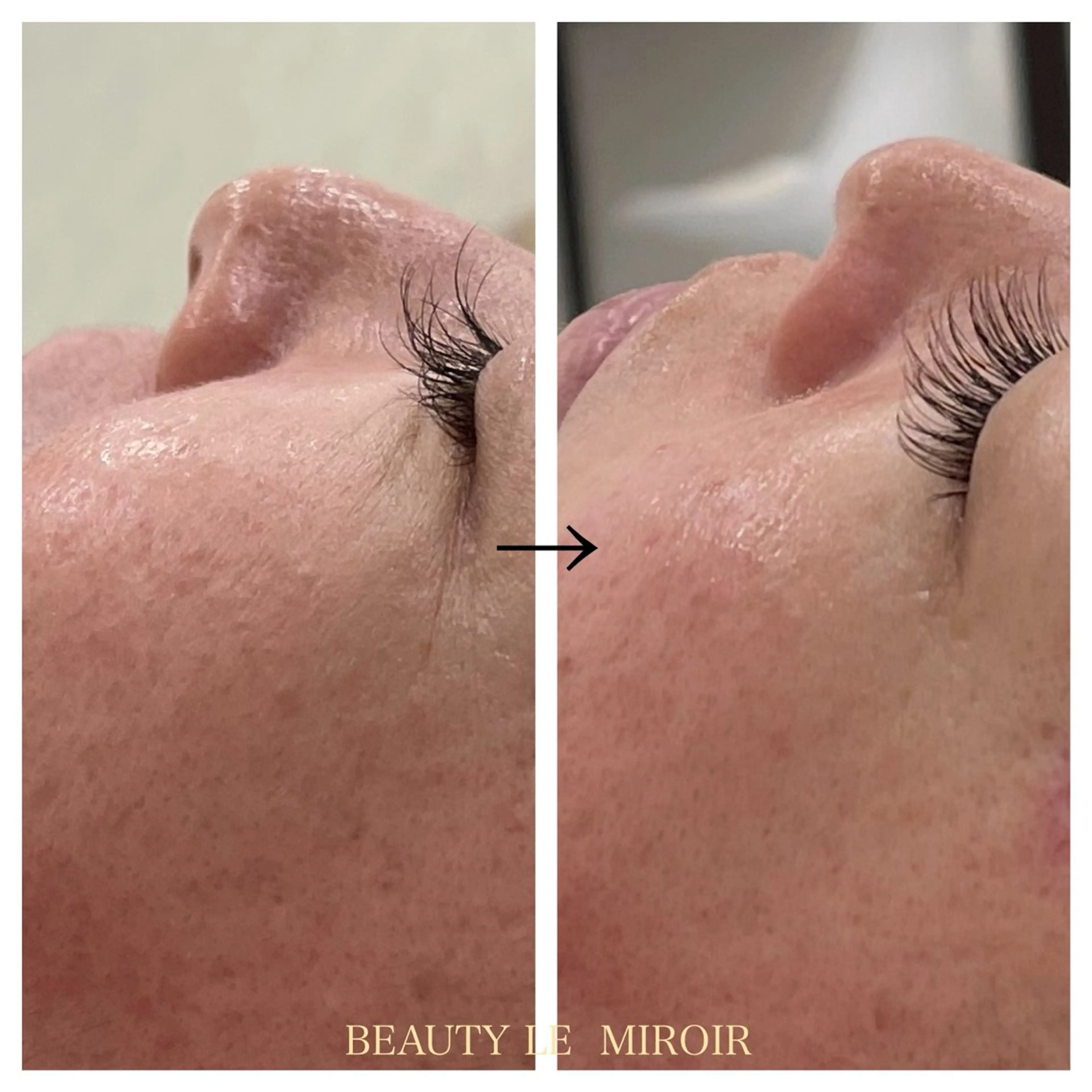 エステ ビューティー ミロワールのエステ・リラクイメージ