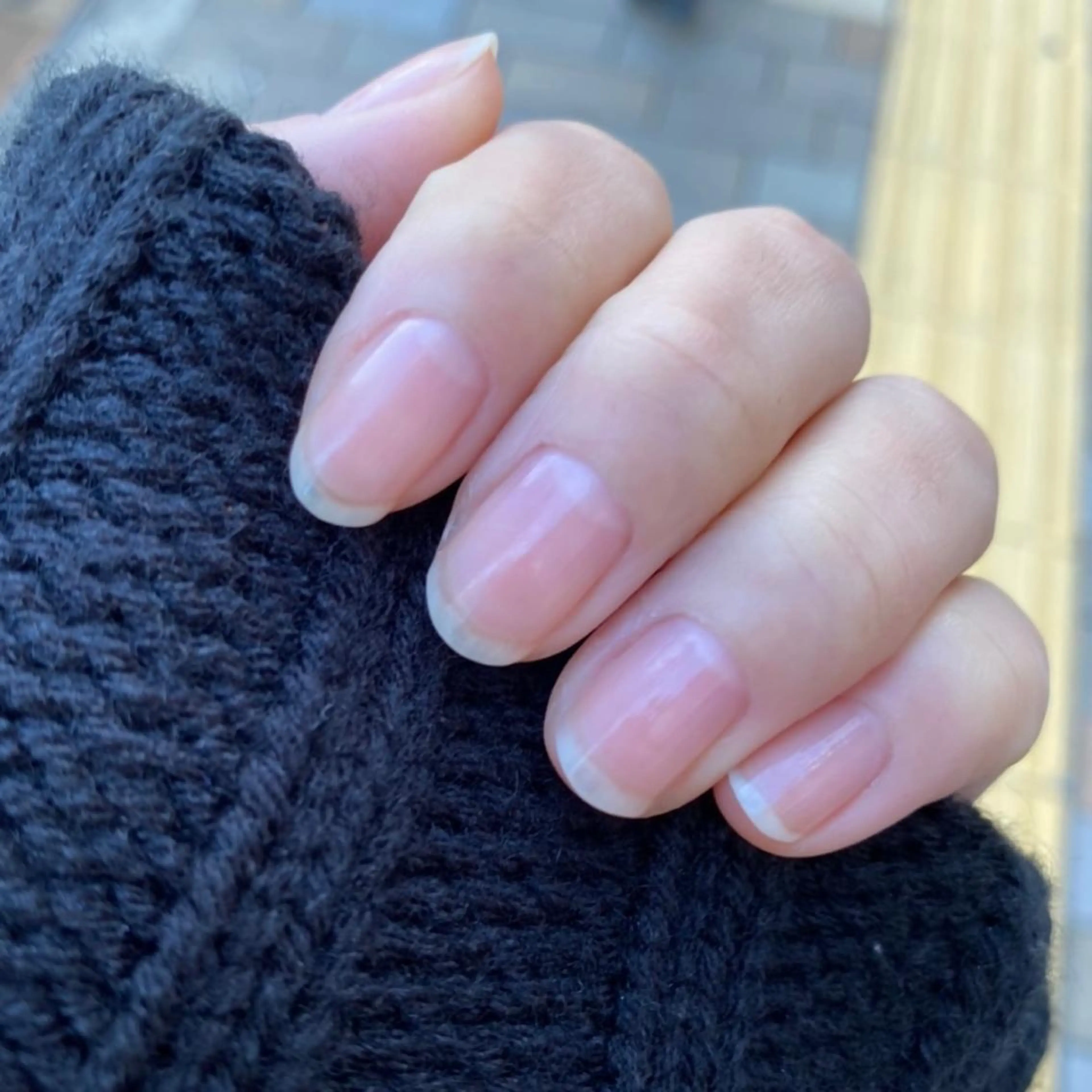 甘皮ケアコースの写真