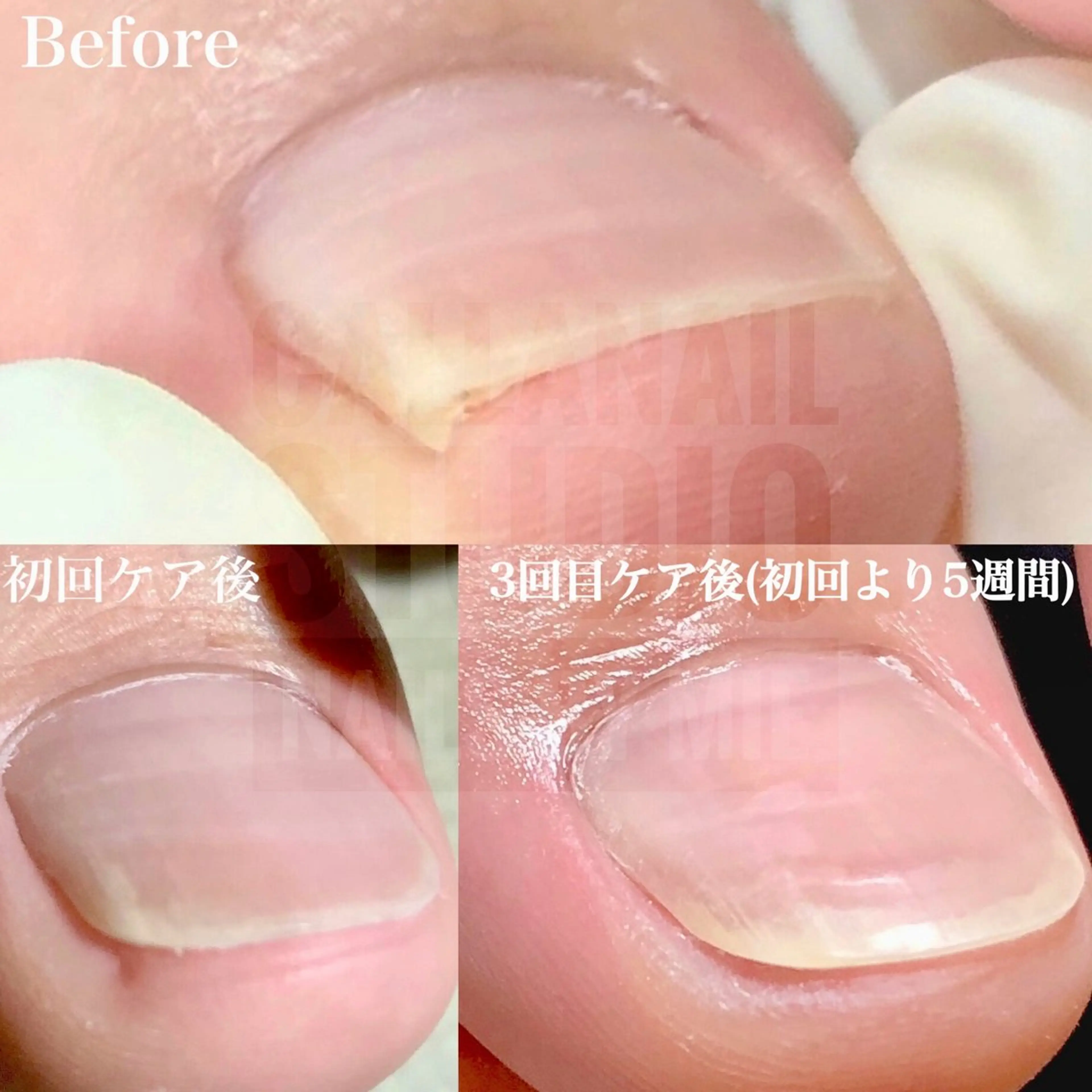 ネイル その他(ネイル) mie ミイのネイルデザイン