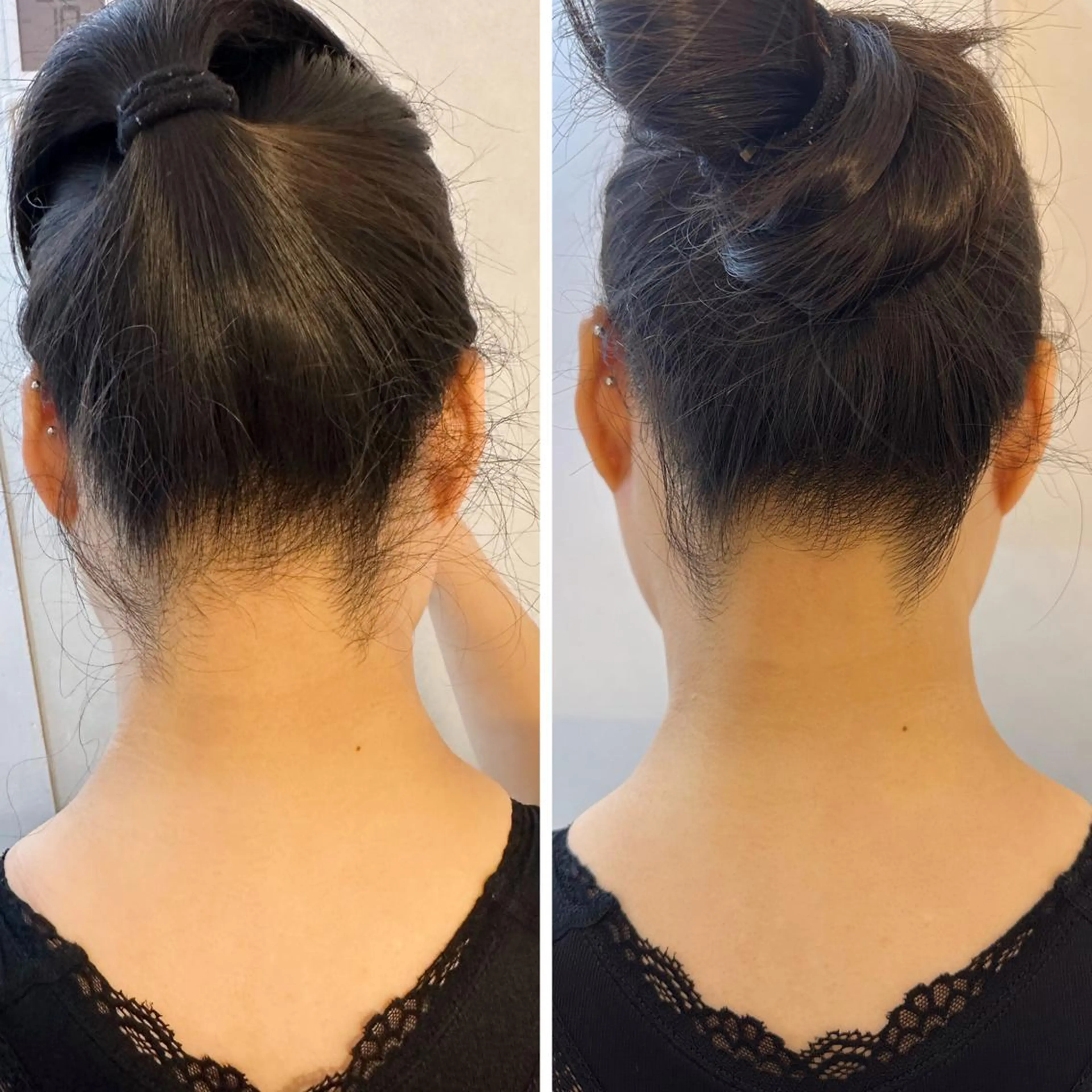 脱毛 うなじ脱毛/美肌脱毛 LABELのエステ・リラクイメージ