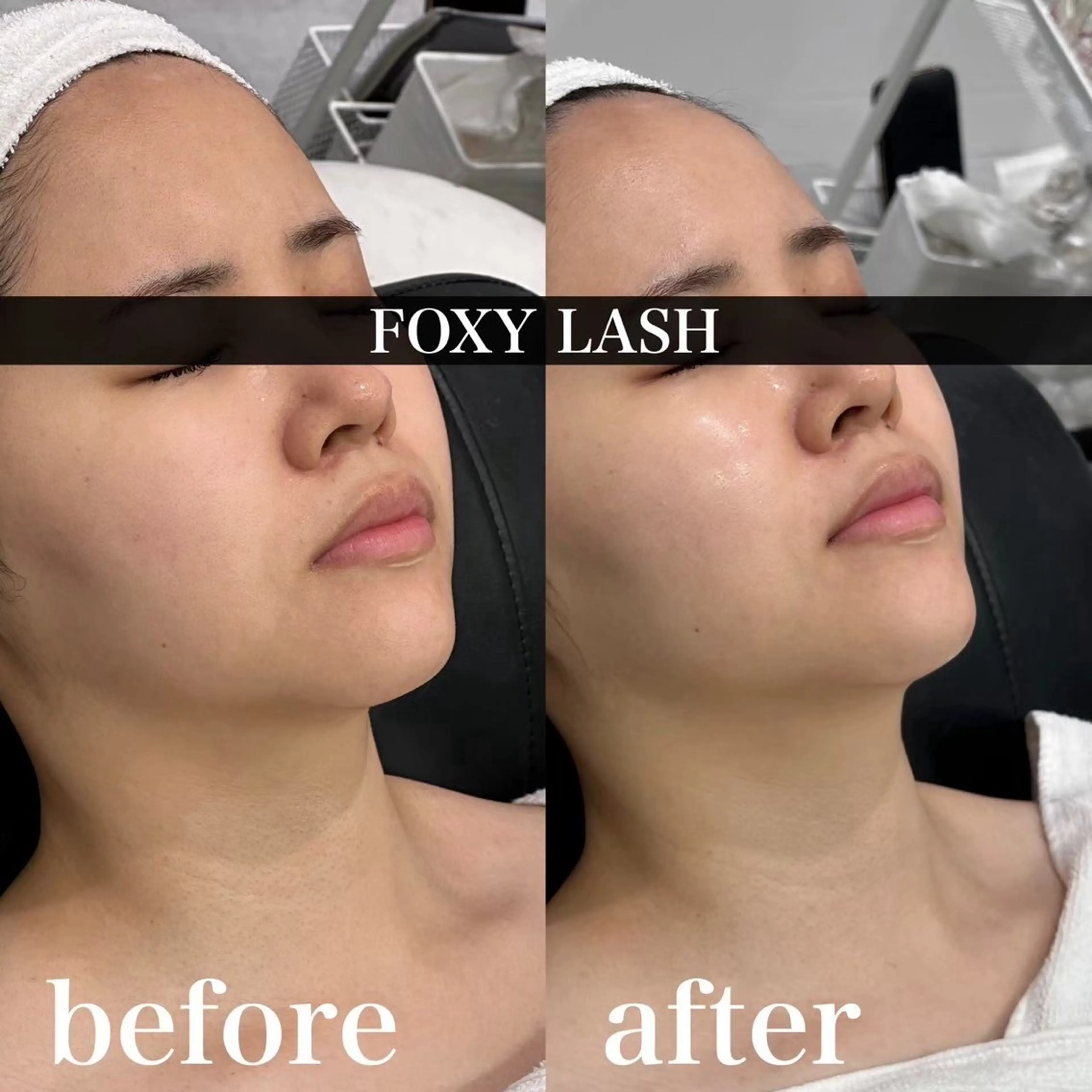 エステ FOXYLASH inoueのエステ・リラクイメージ