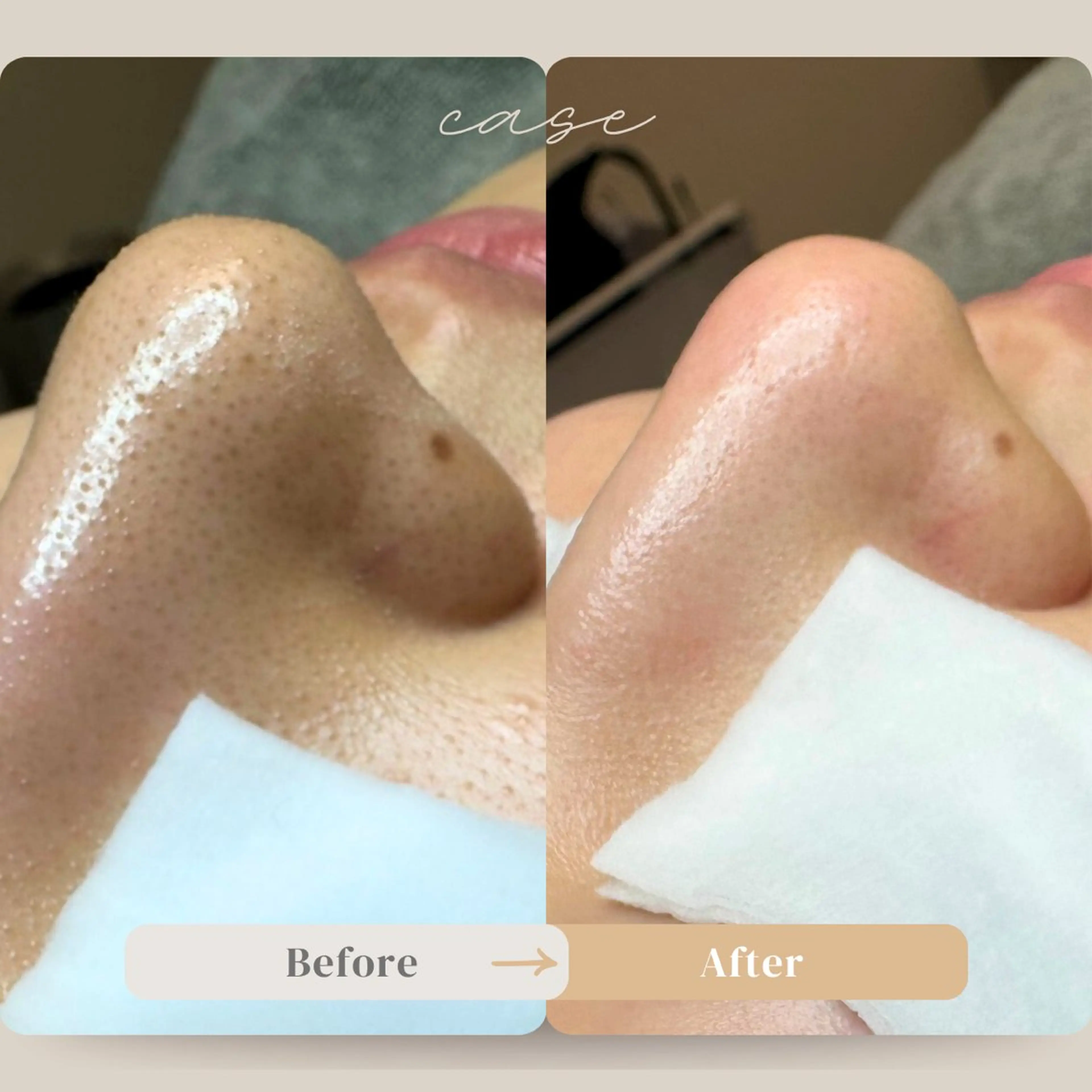 エステ 毛穴ケア特化専門店 トネア自由が丘店のエステ・リラクイメージ