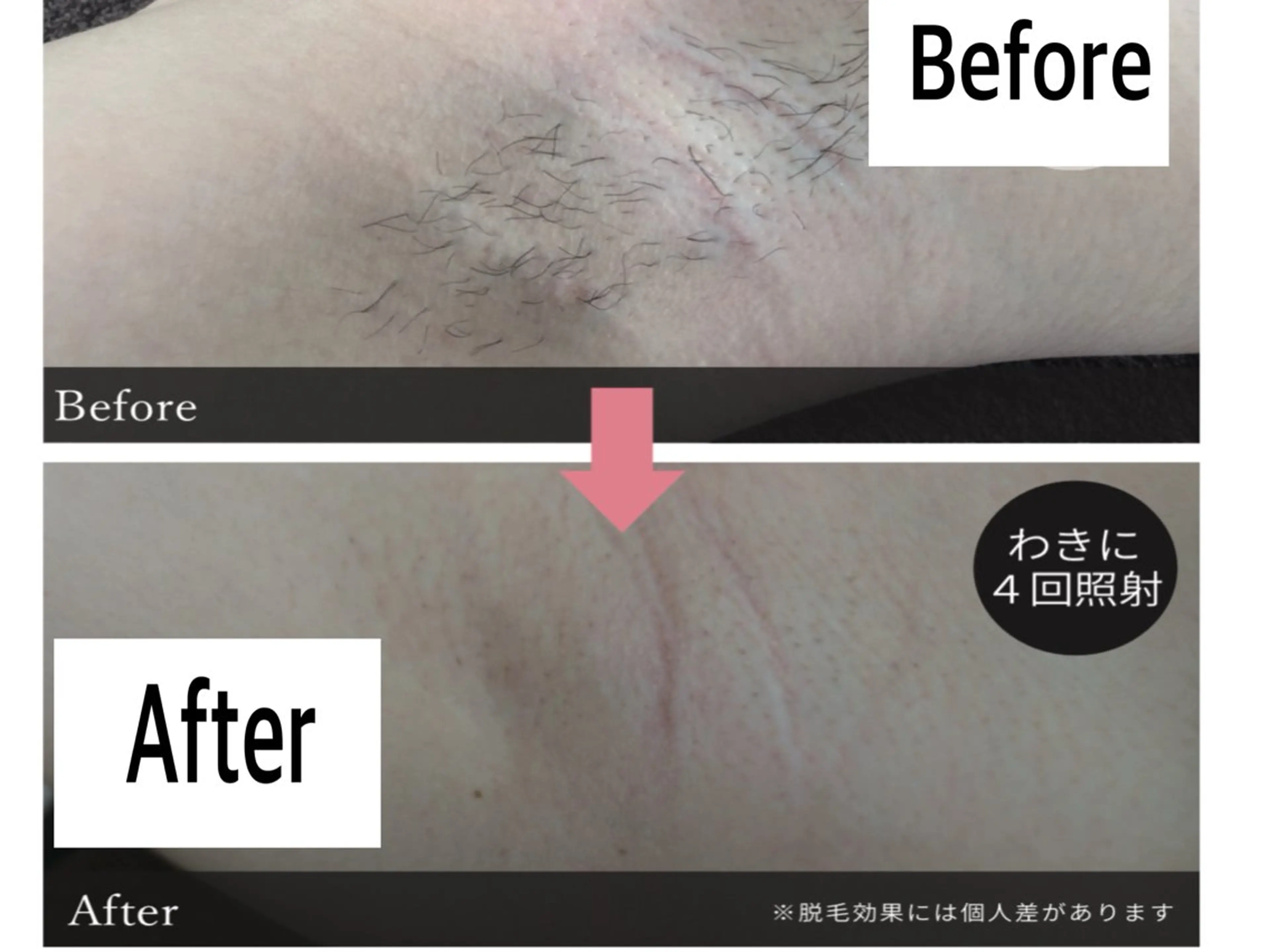 脱毛 プライベートサロン Allureアルーアのエステ・リラクイメージ