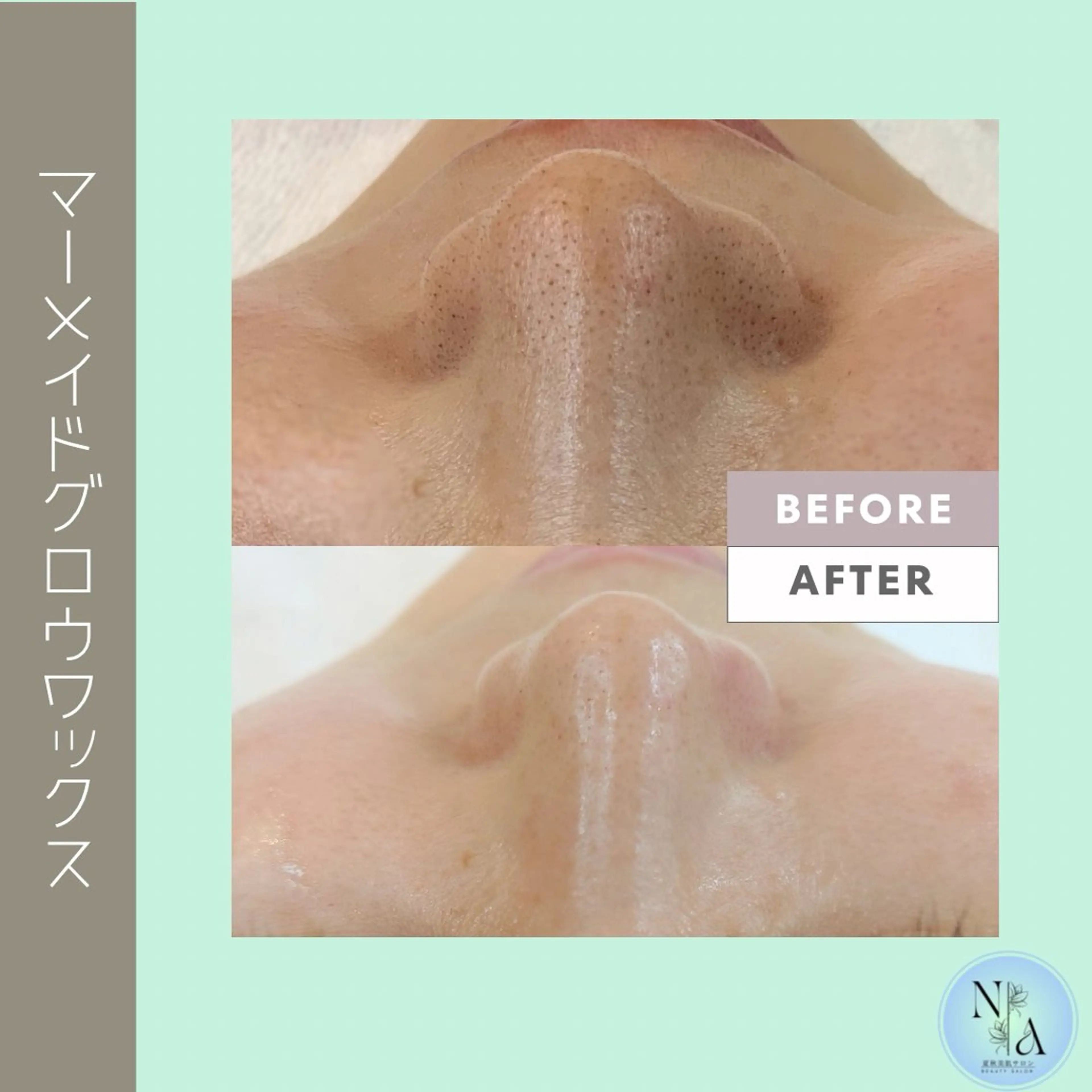 夏秋美肌サロン所属・毛穴改善フェイシャル 夏秋美肌サロンのエステ・リラクイメージ