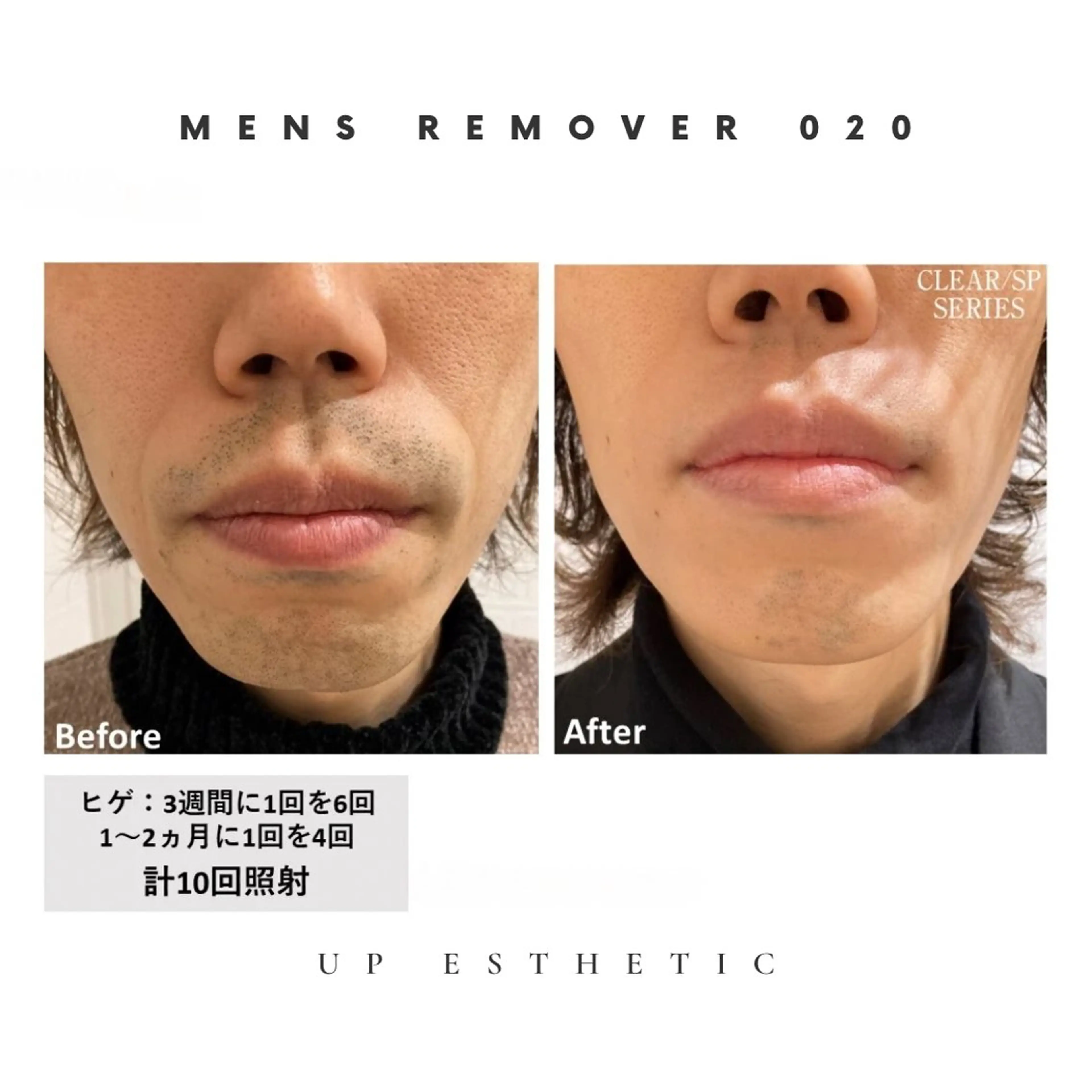 メンズ 韓国肌管理 ウプエステティックのエステ・リラクイメージ