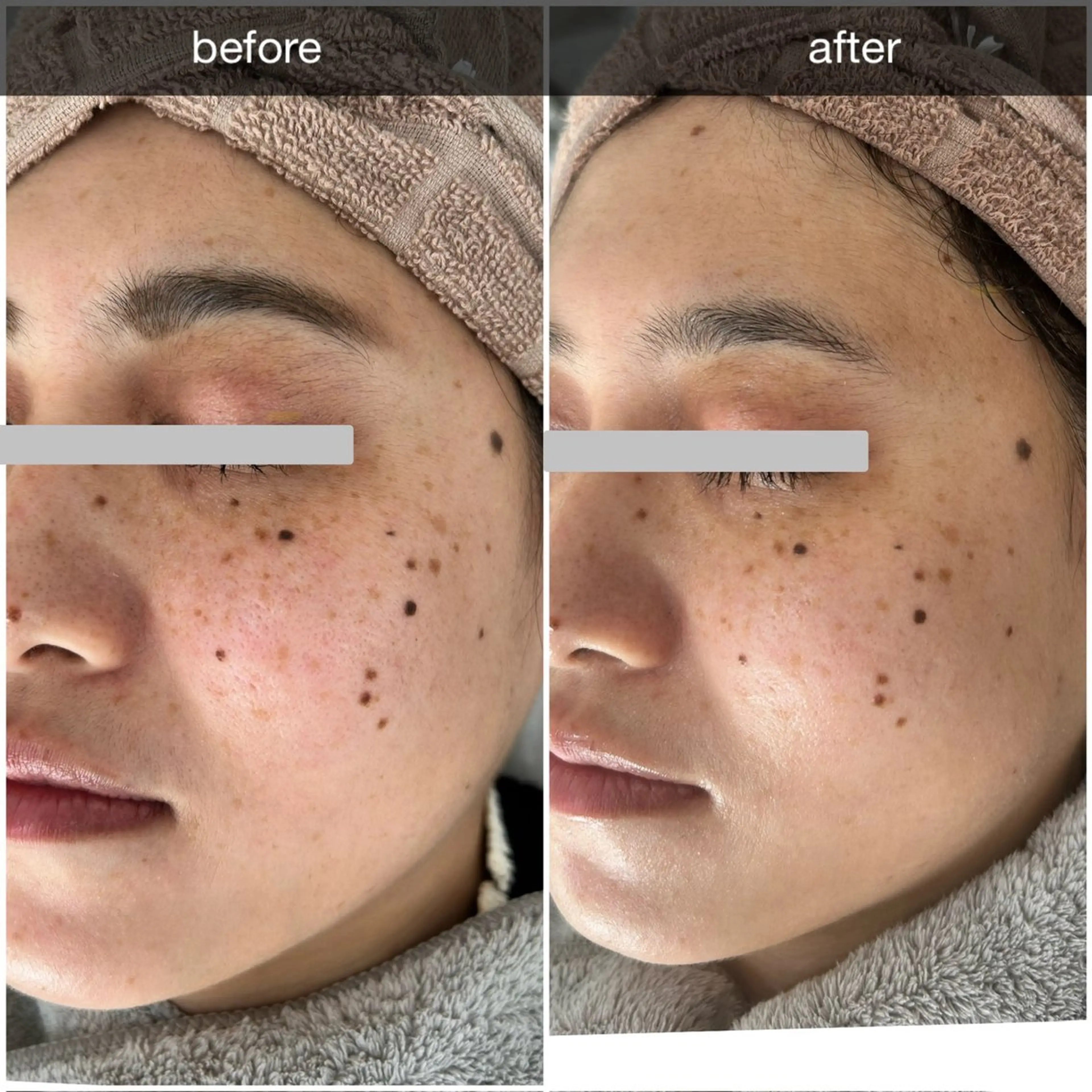 エステ プレジール所属・ビューティサロン プレジールOTAKEのエステ・リラクイメージ