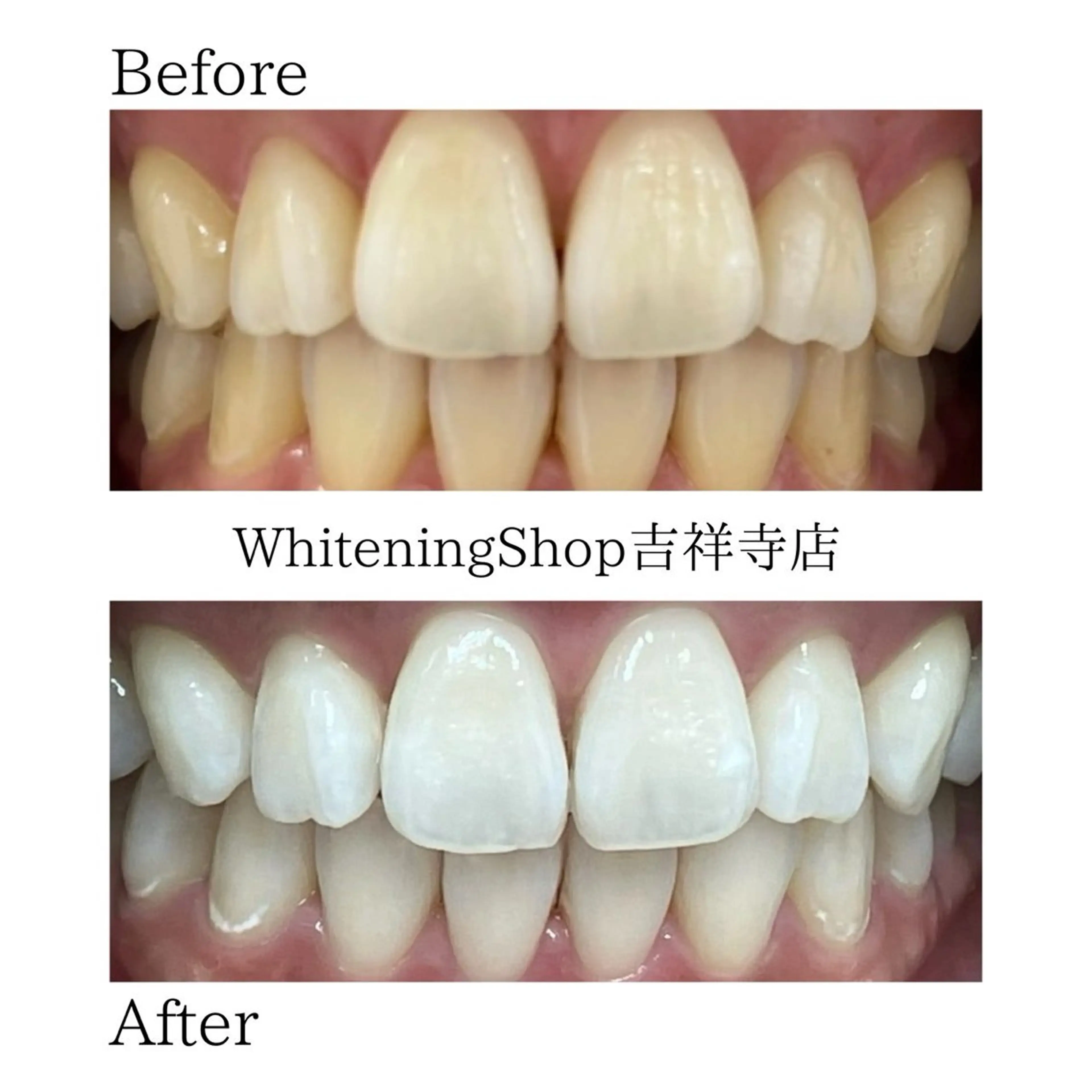 エステ リラク ホワイトニング ショップ吉祥寺店のエステ・リラクイメージ