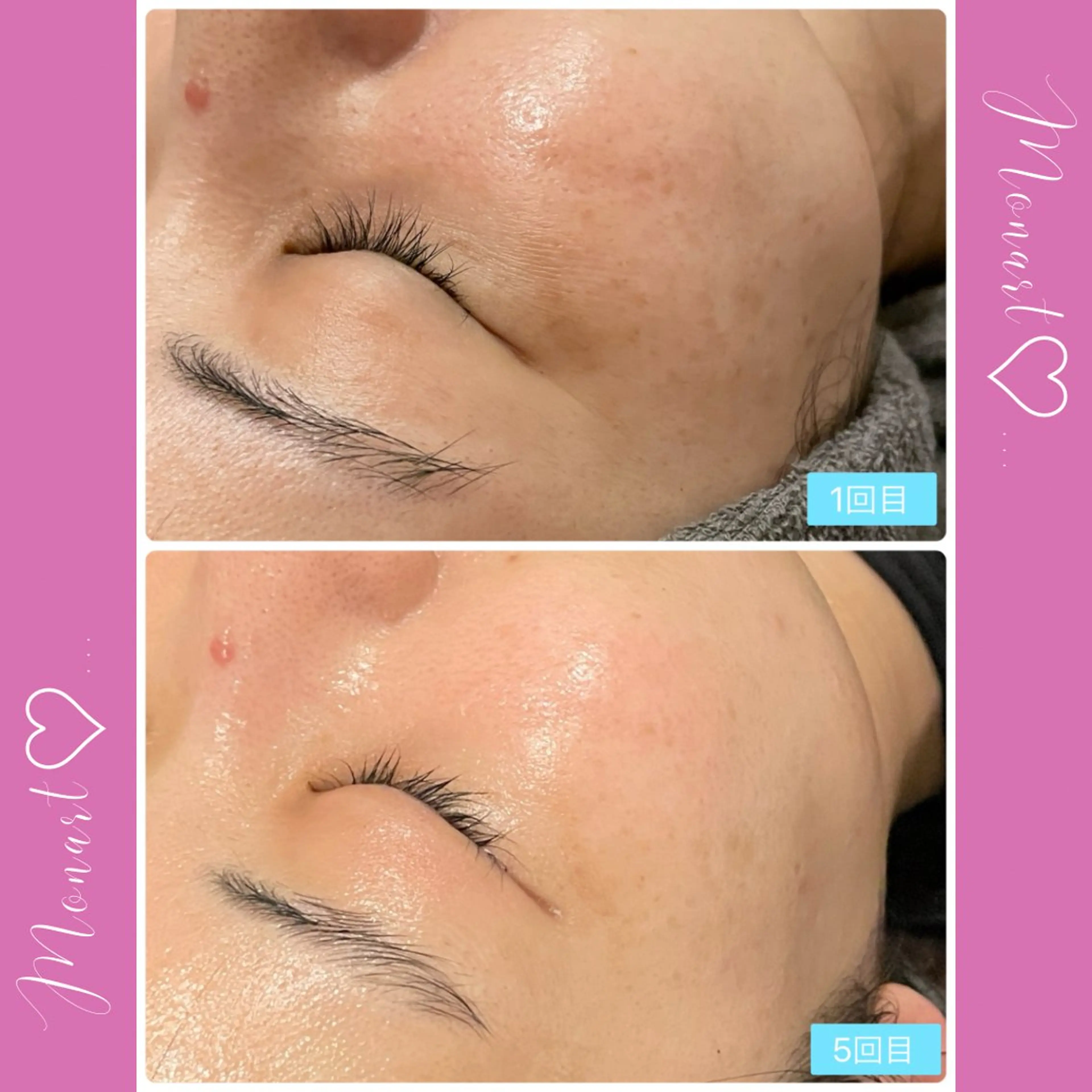 Monart -deux-のエステ・リラクイメージ