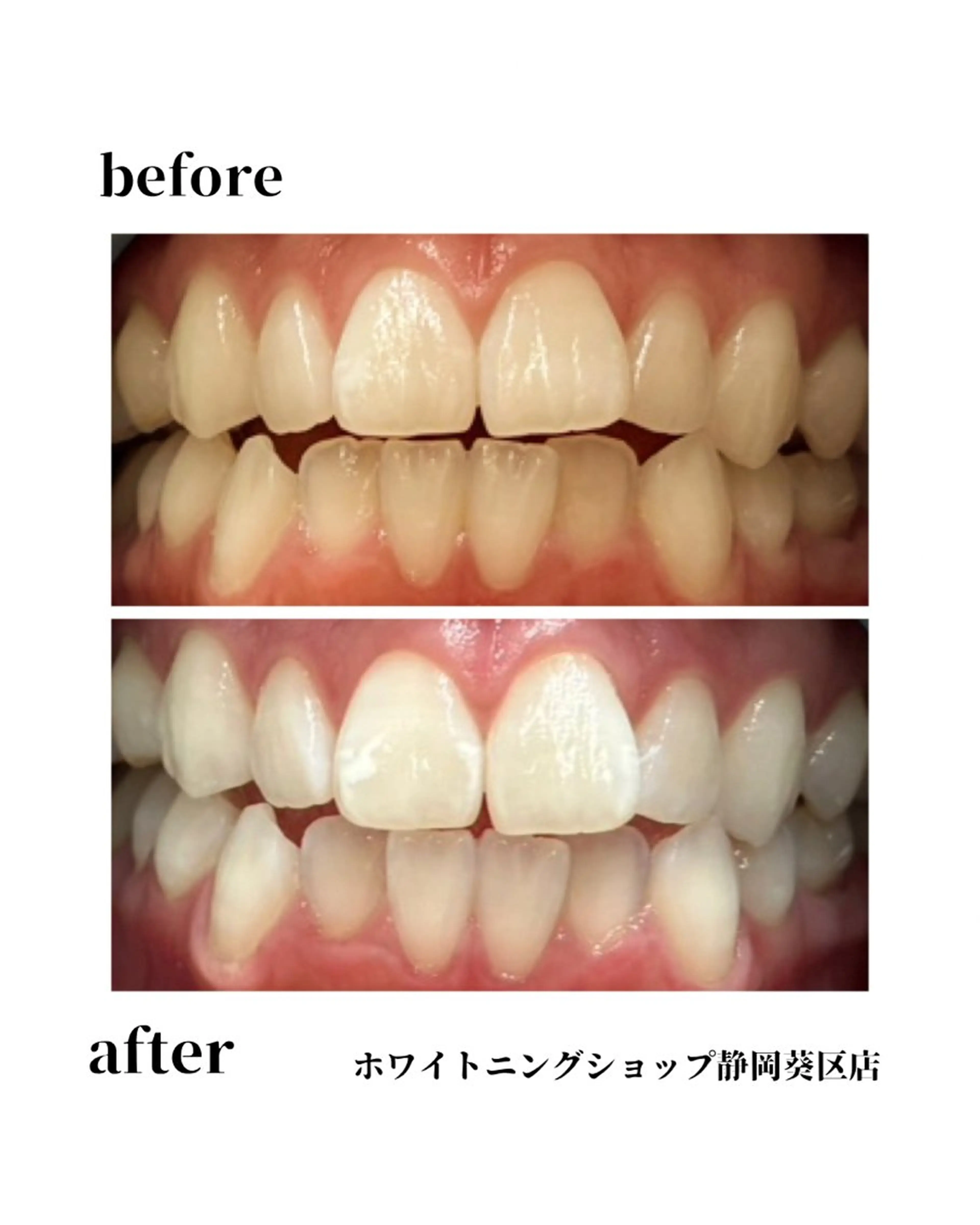 ホワイトニング ショップ葵区静岡駅店のその他イメージ