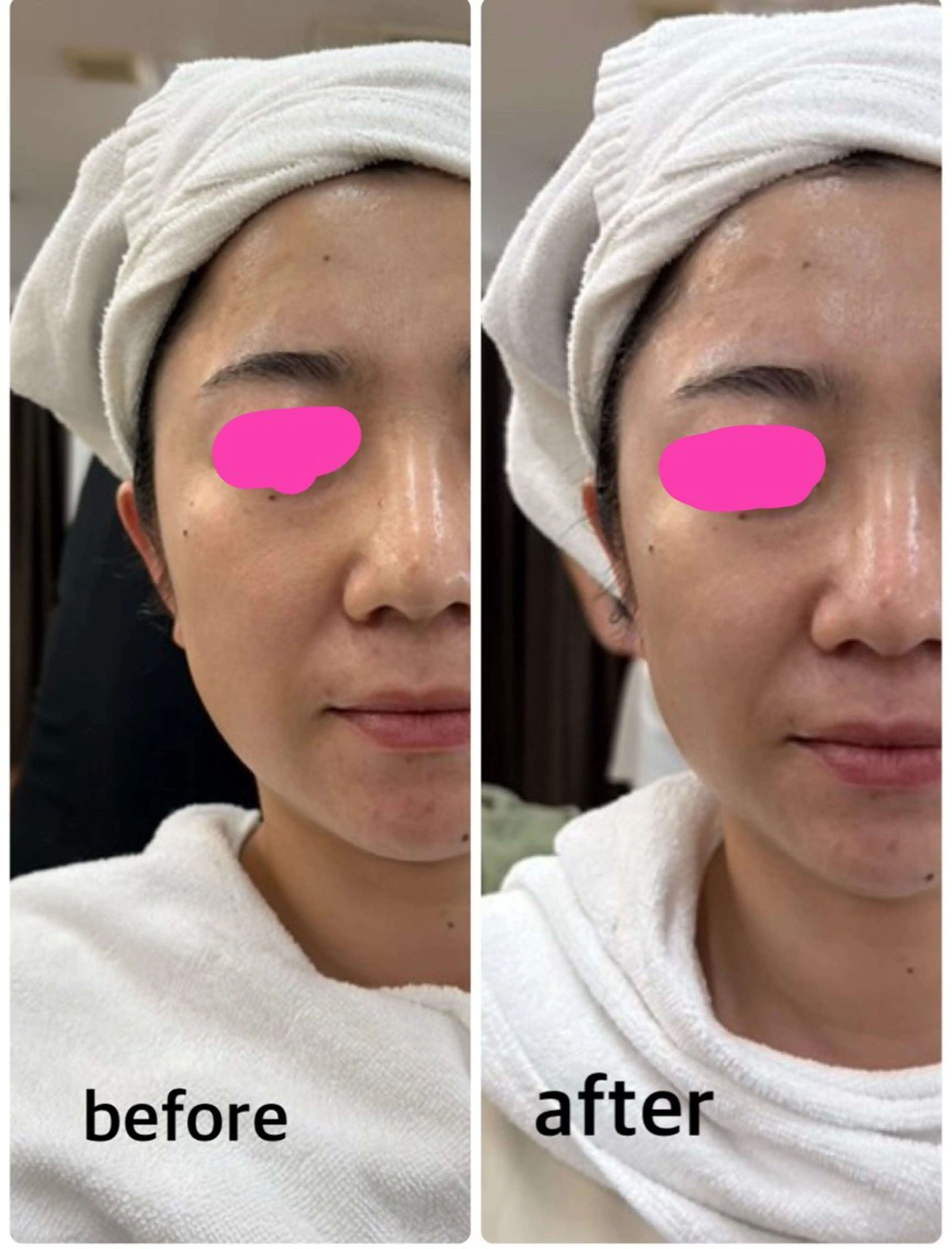 デアイム甲府所属・つかだ りょうこのエステ・リラクイメージ