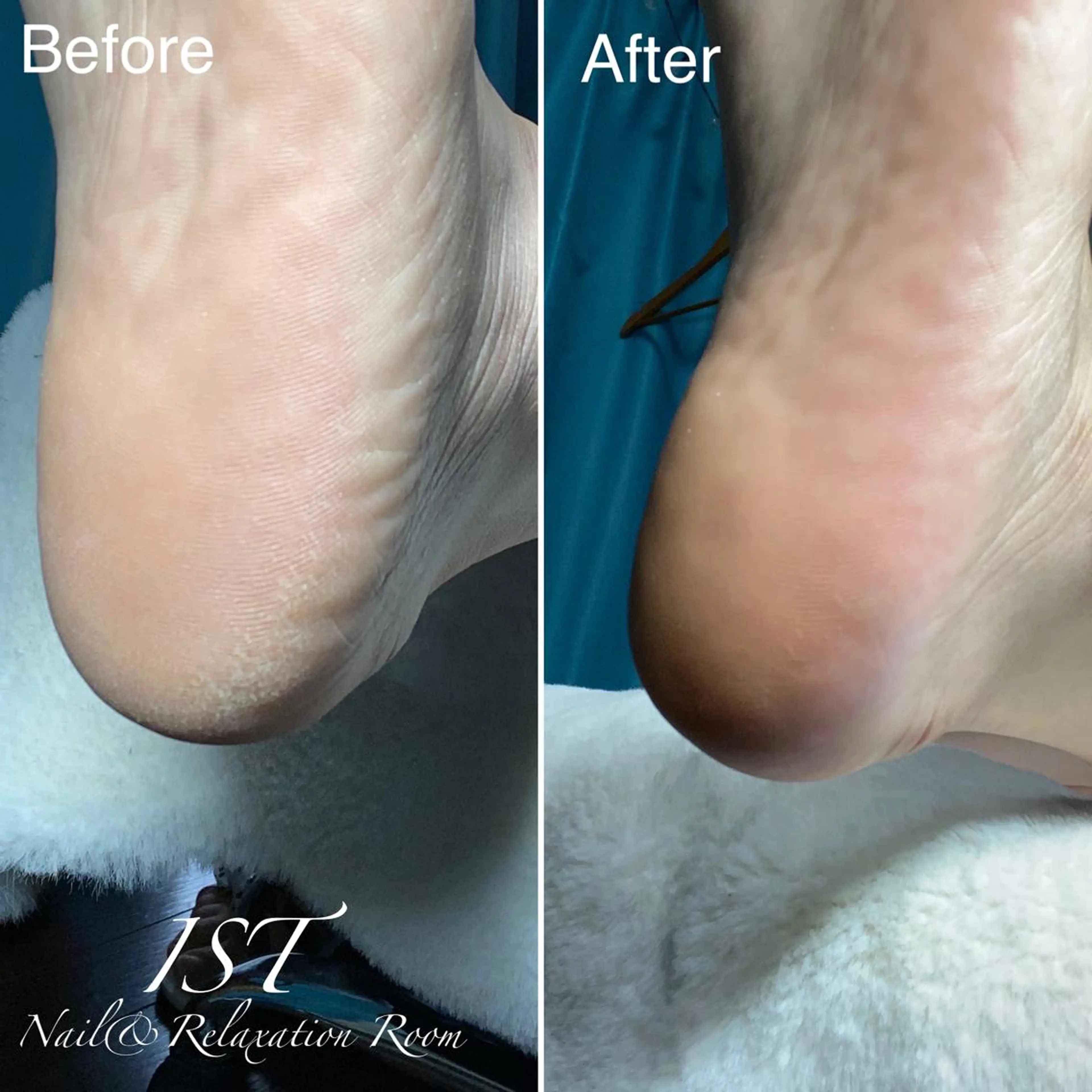 ネイル メンズ歓迎🙆‍♀️ エステ/ネイルISTのネイルデザイン