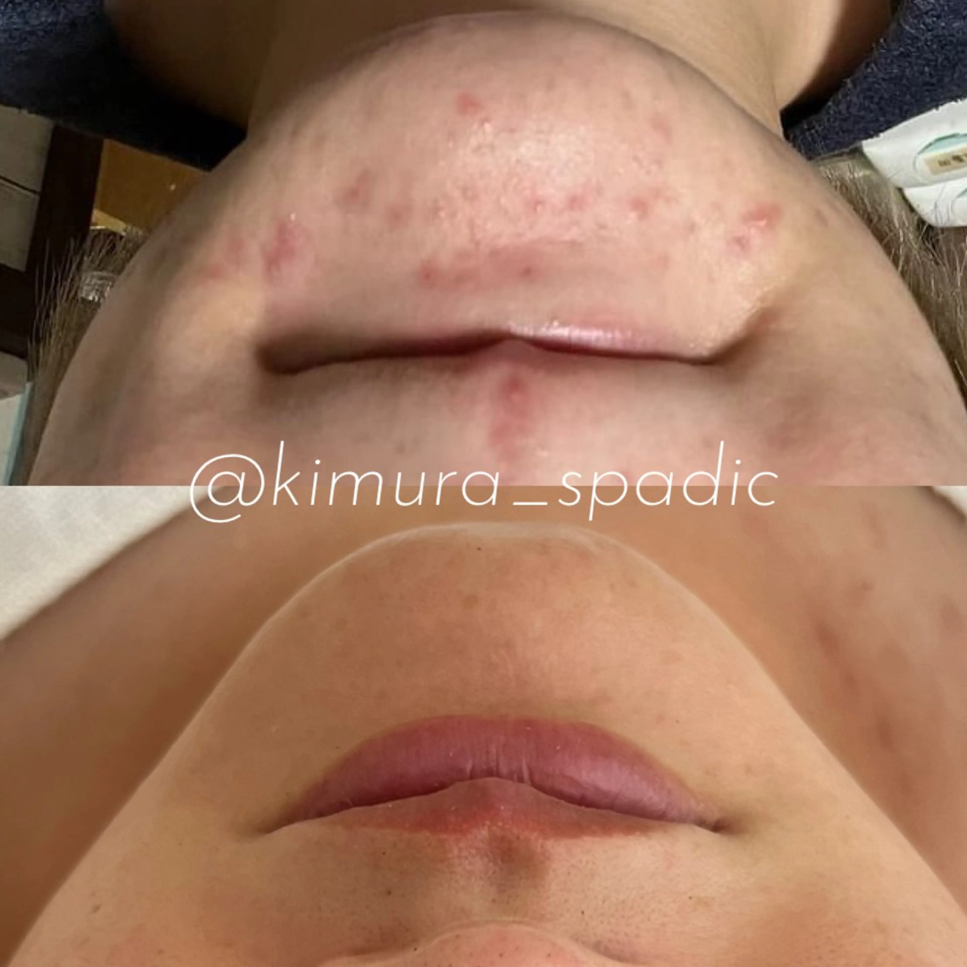 SPADIC中目黒所属・木村 ゆきのエステ・リラクイメージ