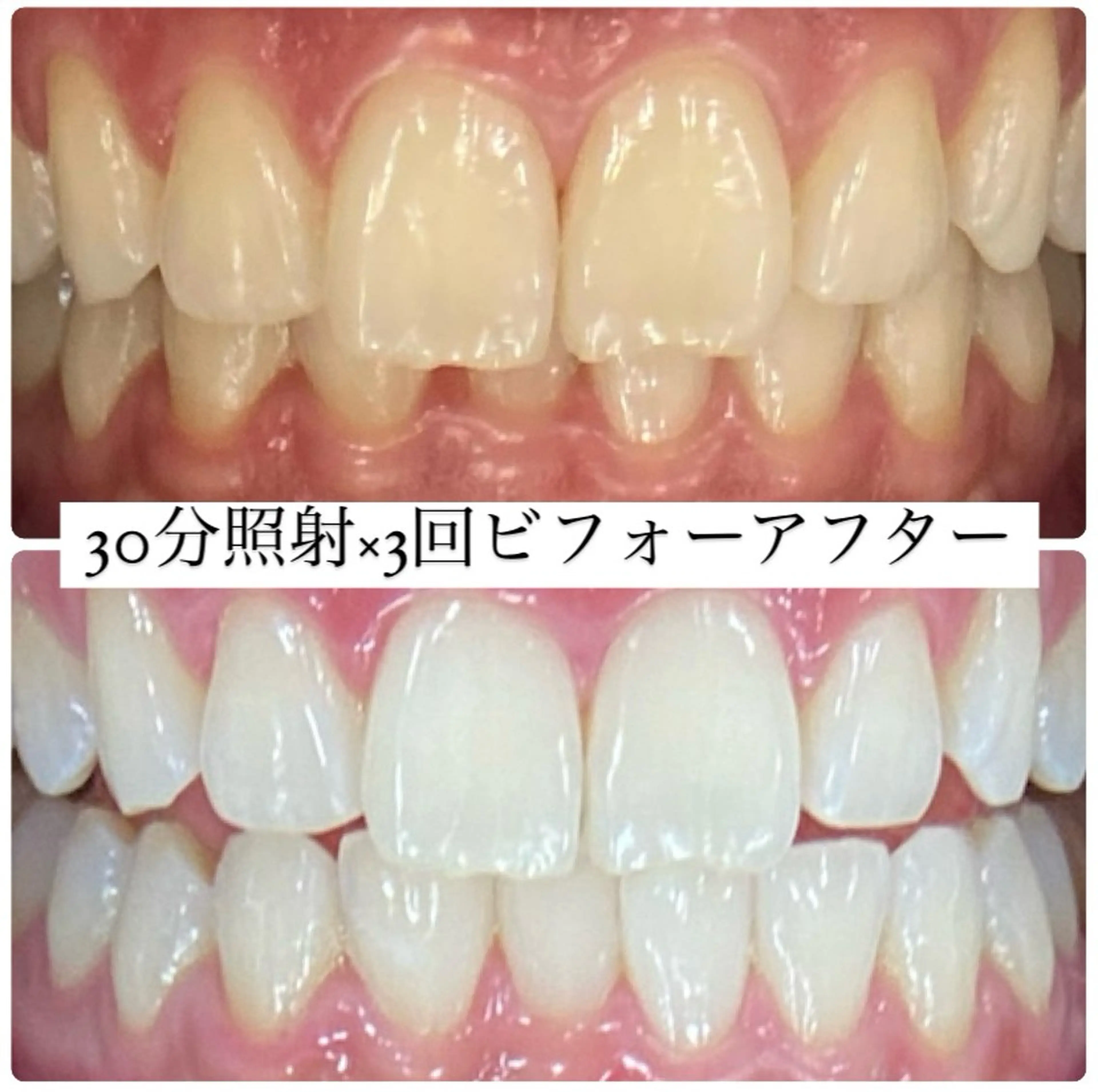 PLATINUM Beauty 横浜店所属・ホワイトニングルーム 横浜店のその他イメージ