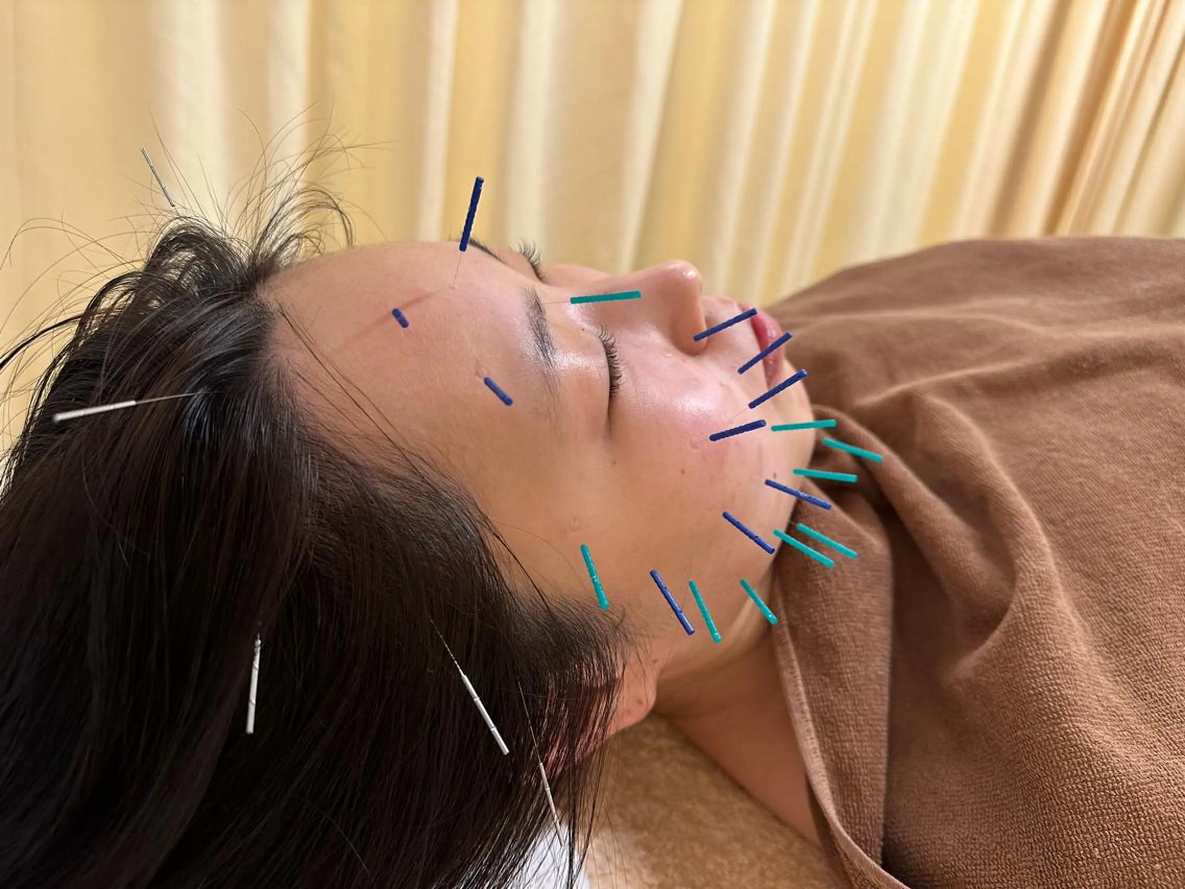 その他 鍼灸サロン BBB3のその他イメージ