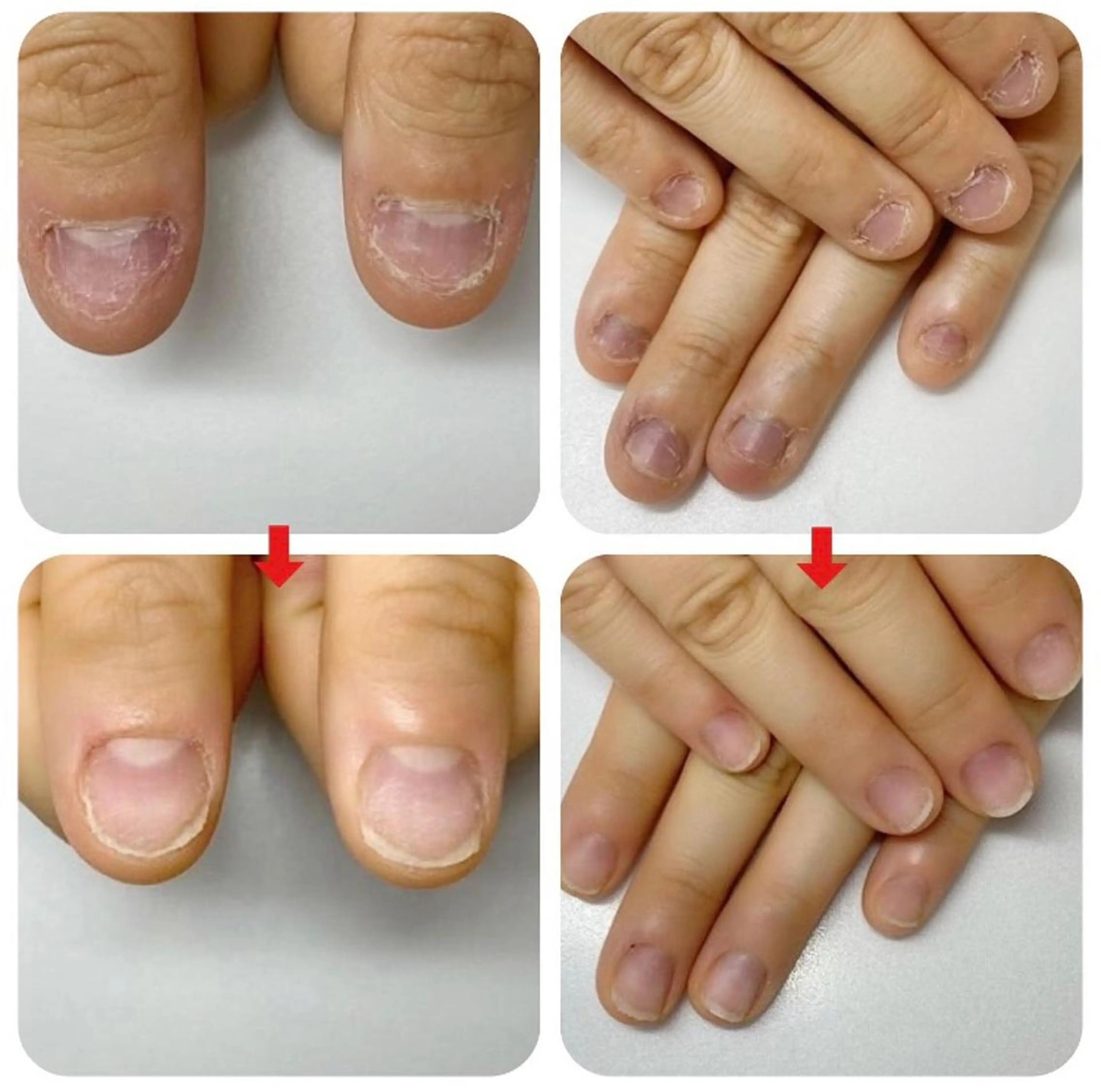 ネイル ネイルサロン アリュームのネイルデザイン