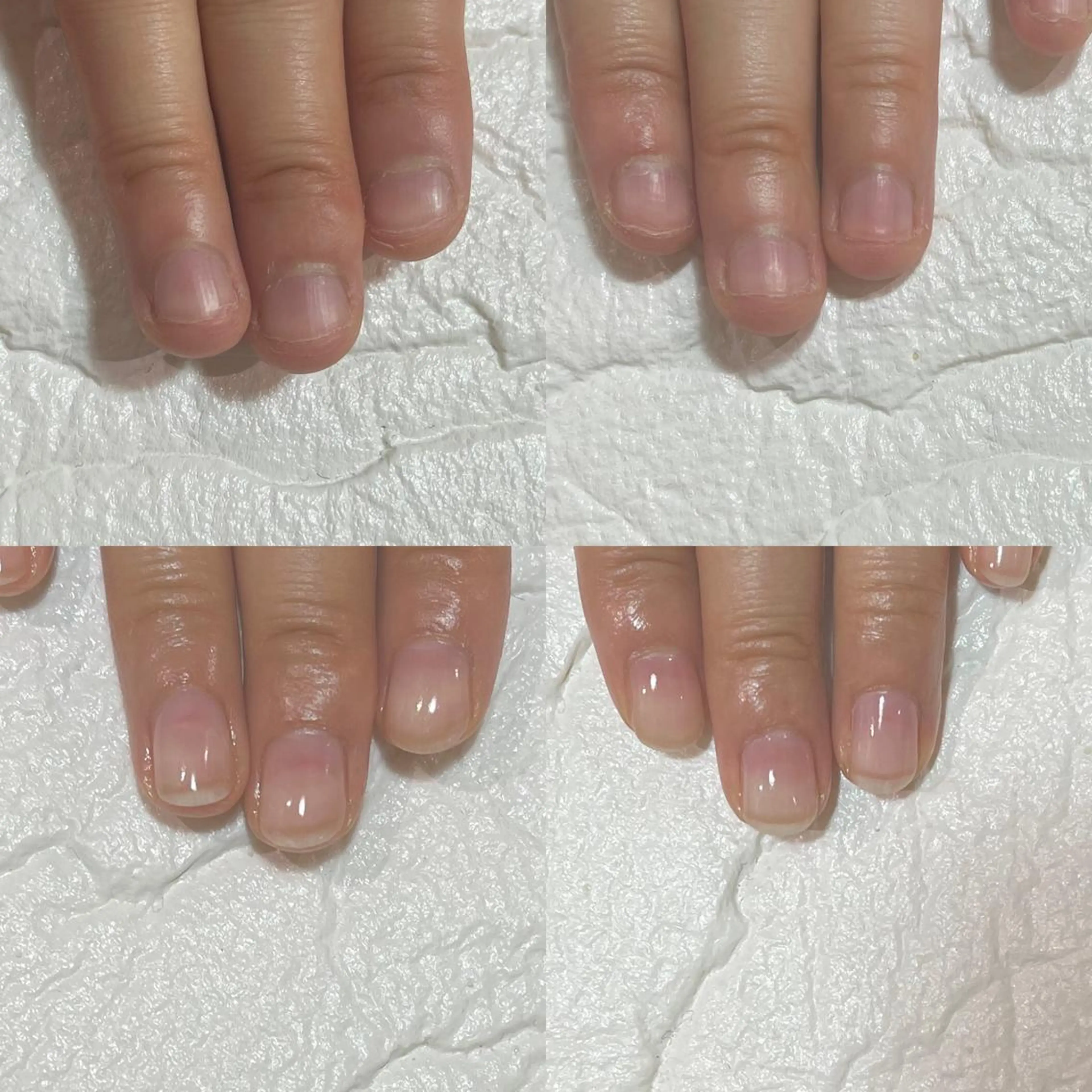 ネイル 自爪育成・巻き爪 補正講師　津蔵のネイルデザイン