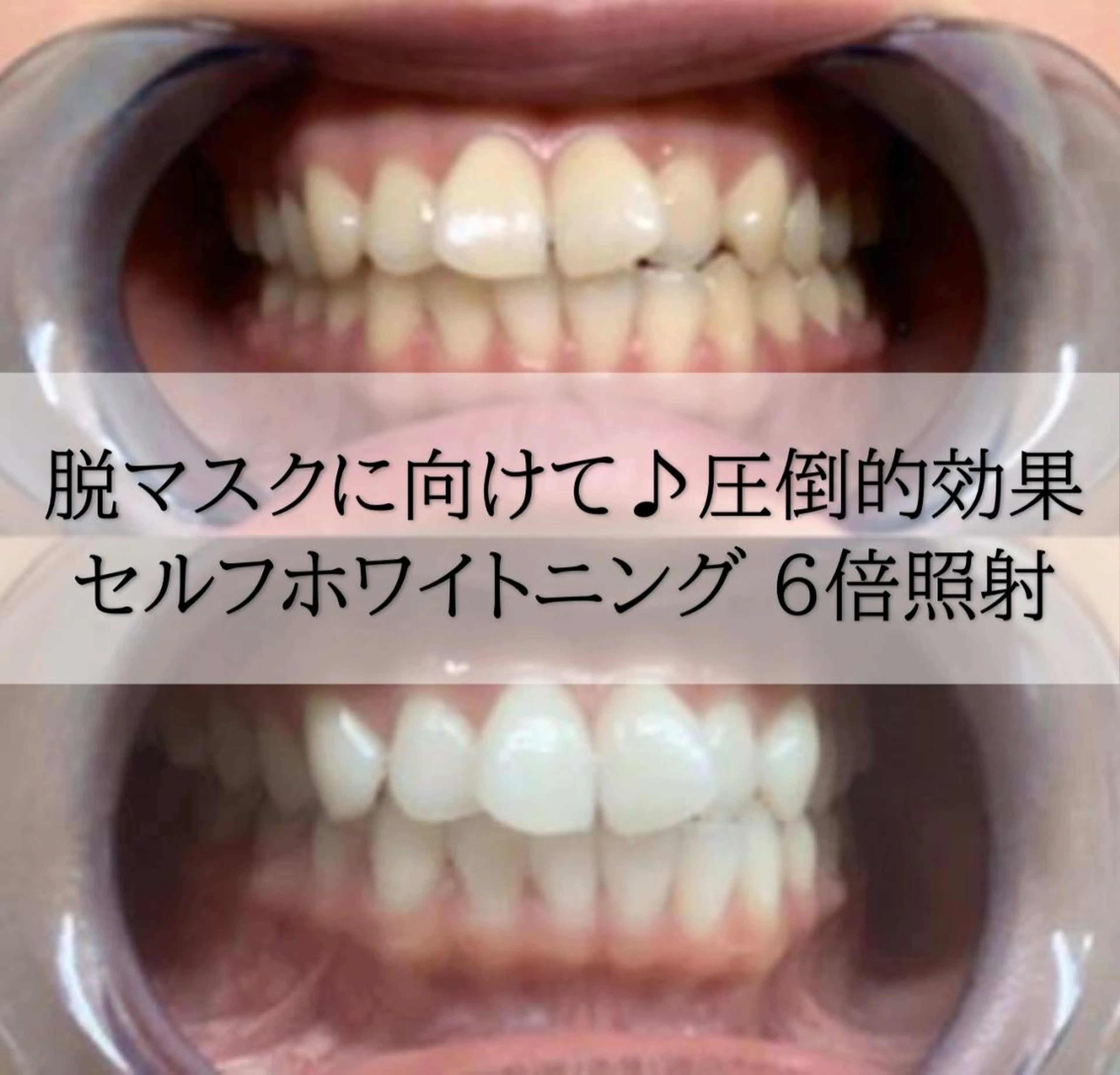 その他 ホワイトニング専門店 LCS 新橋店 佐藤のその他イメージ