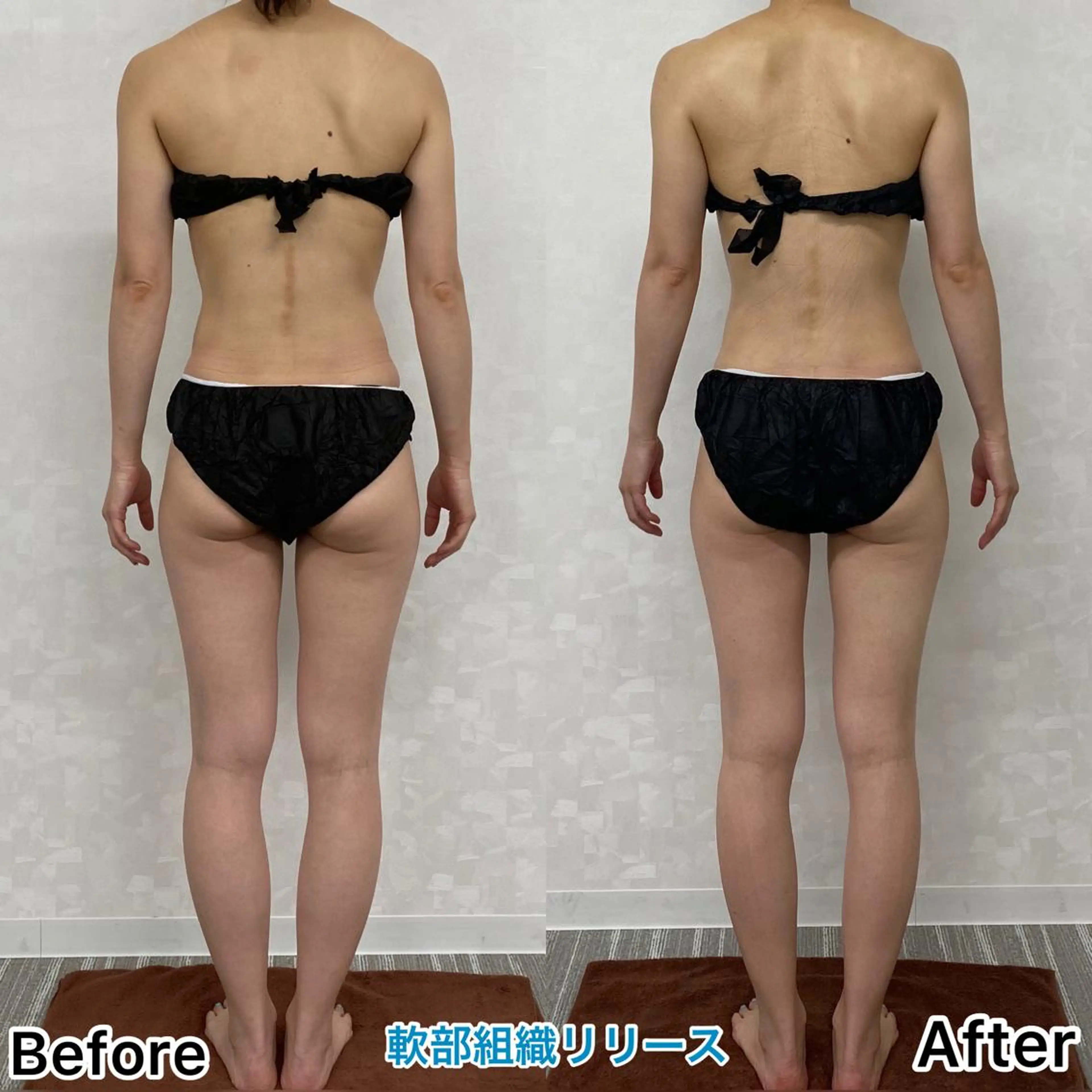 パラ・ ディのエステ・リラクイメージ