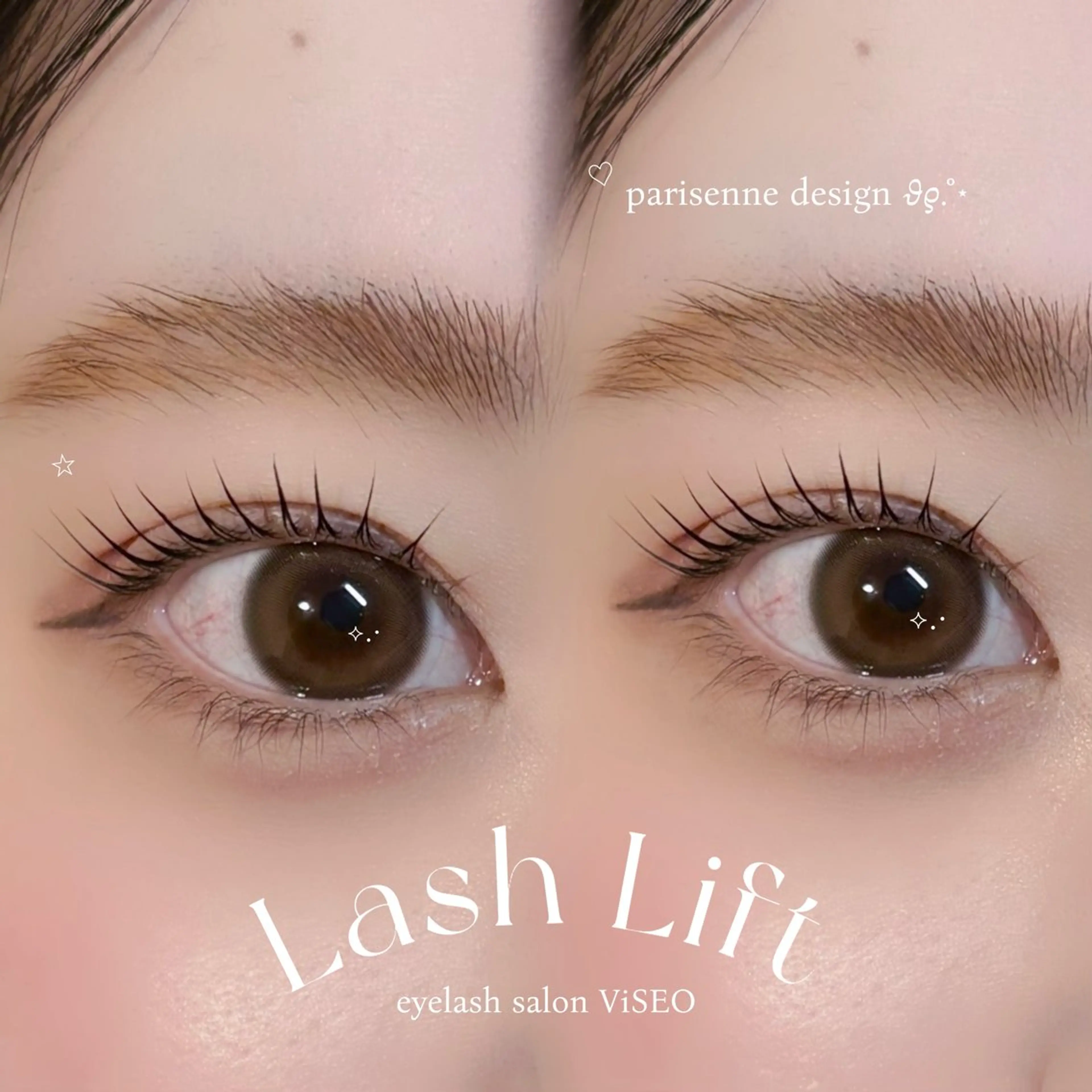 上下パーマの写真