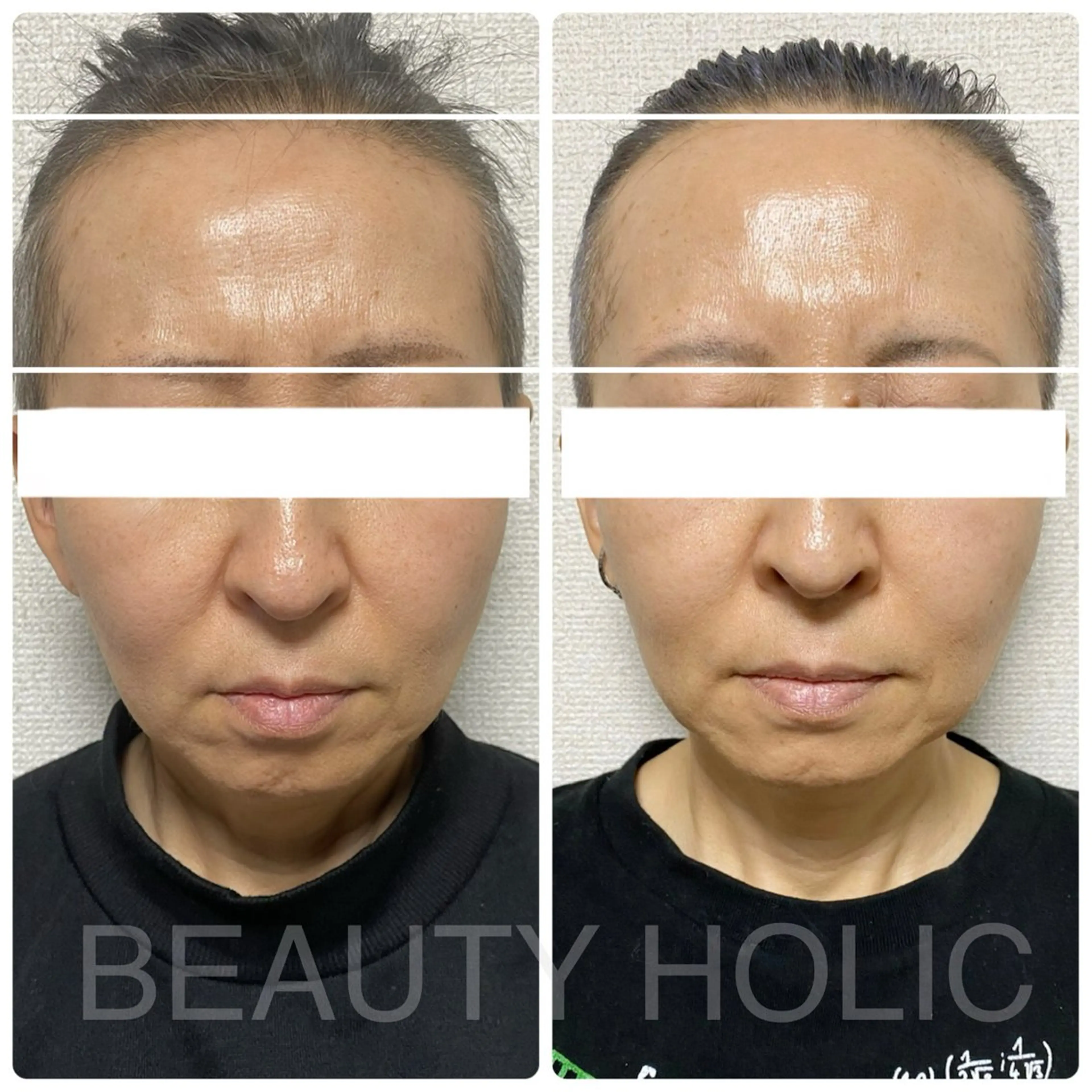 ビューティーホリック 東金店のエステ・リラクイメージ