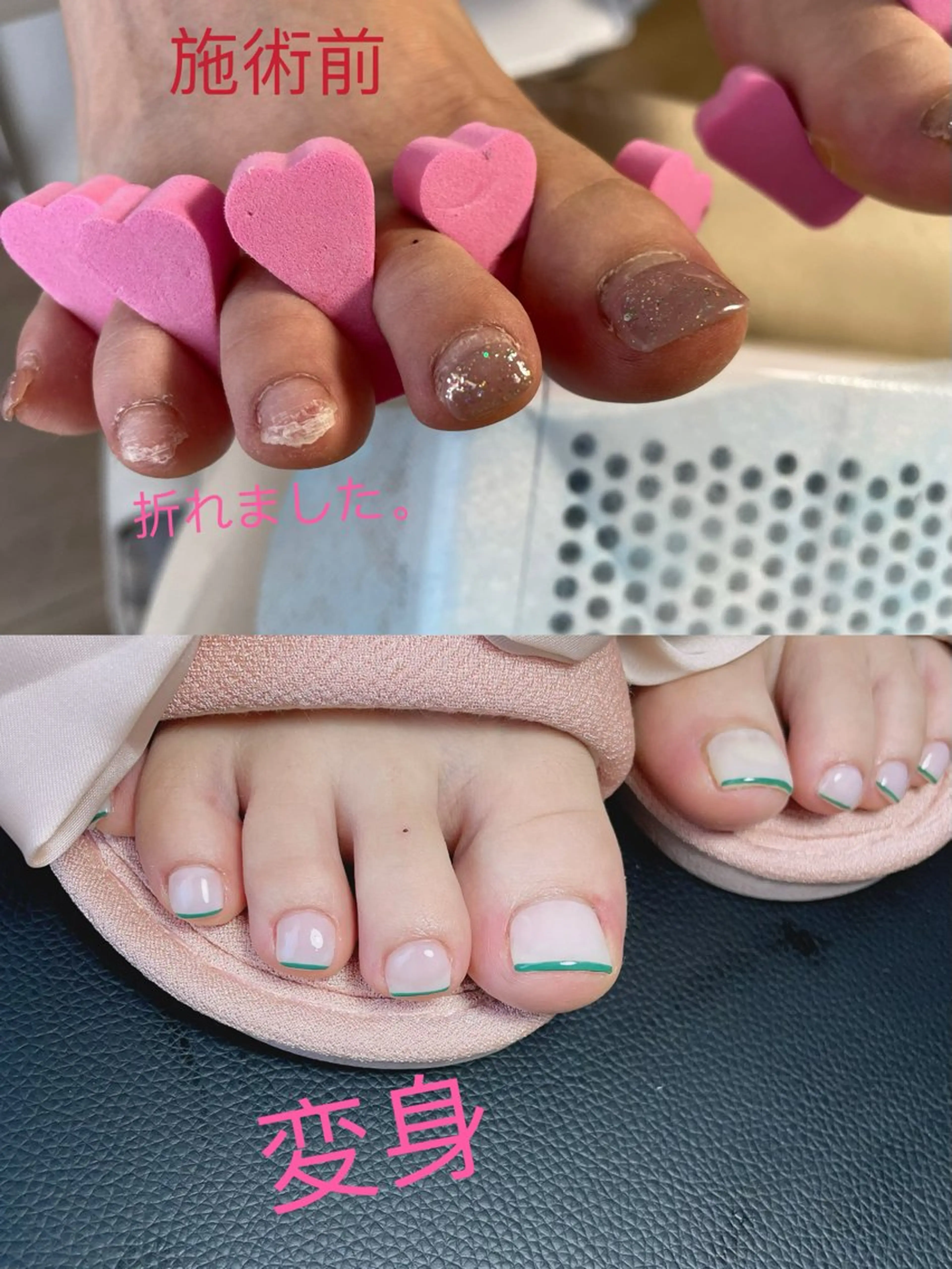 ネイル フットネイル Ai Nailのネイルデザイン