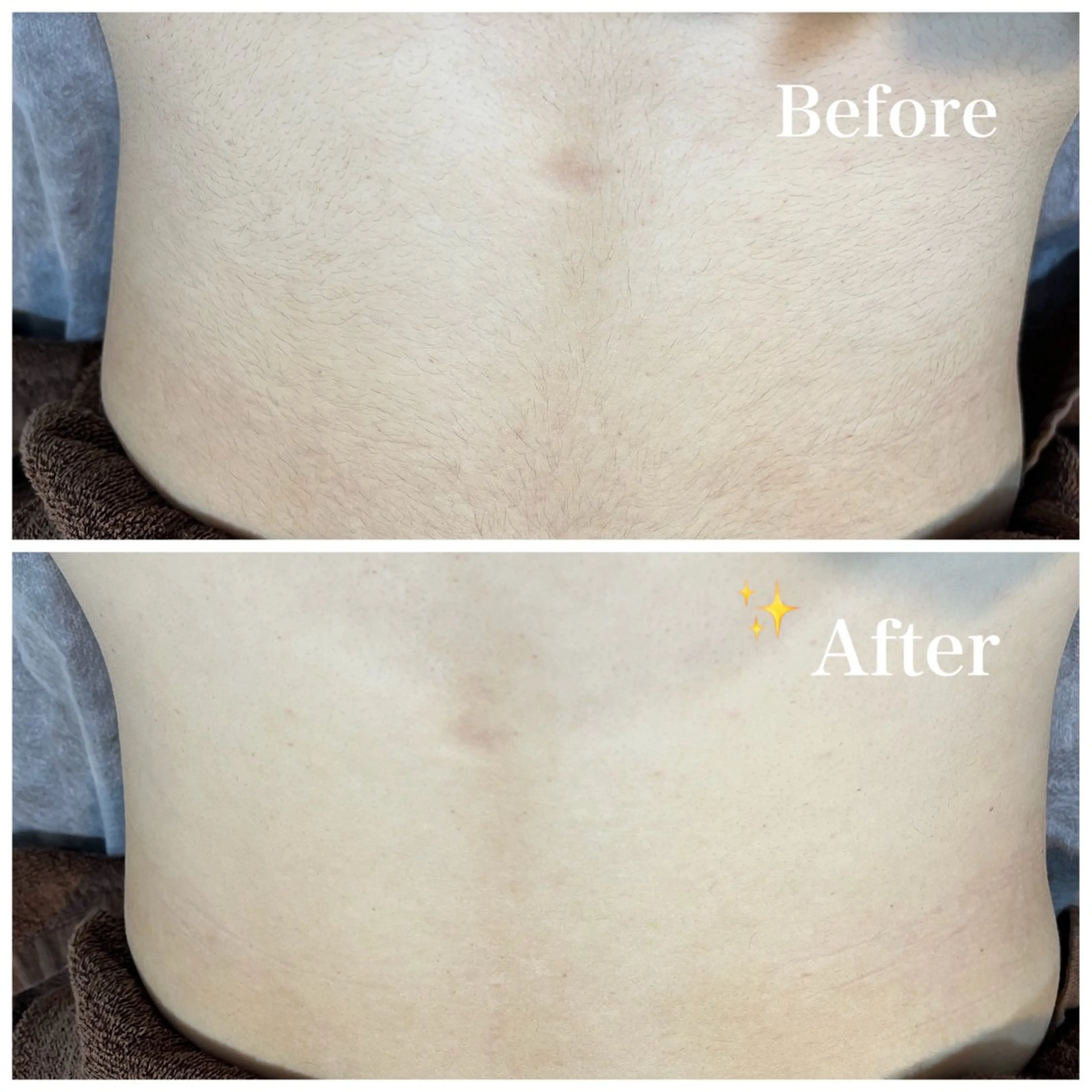 脱毛 脱毛サロン fam.豊澤柚良のエステ・リラクイメージ