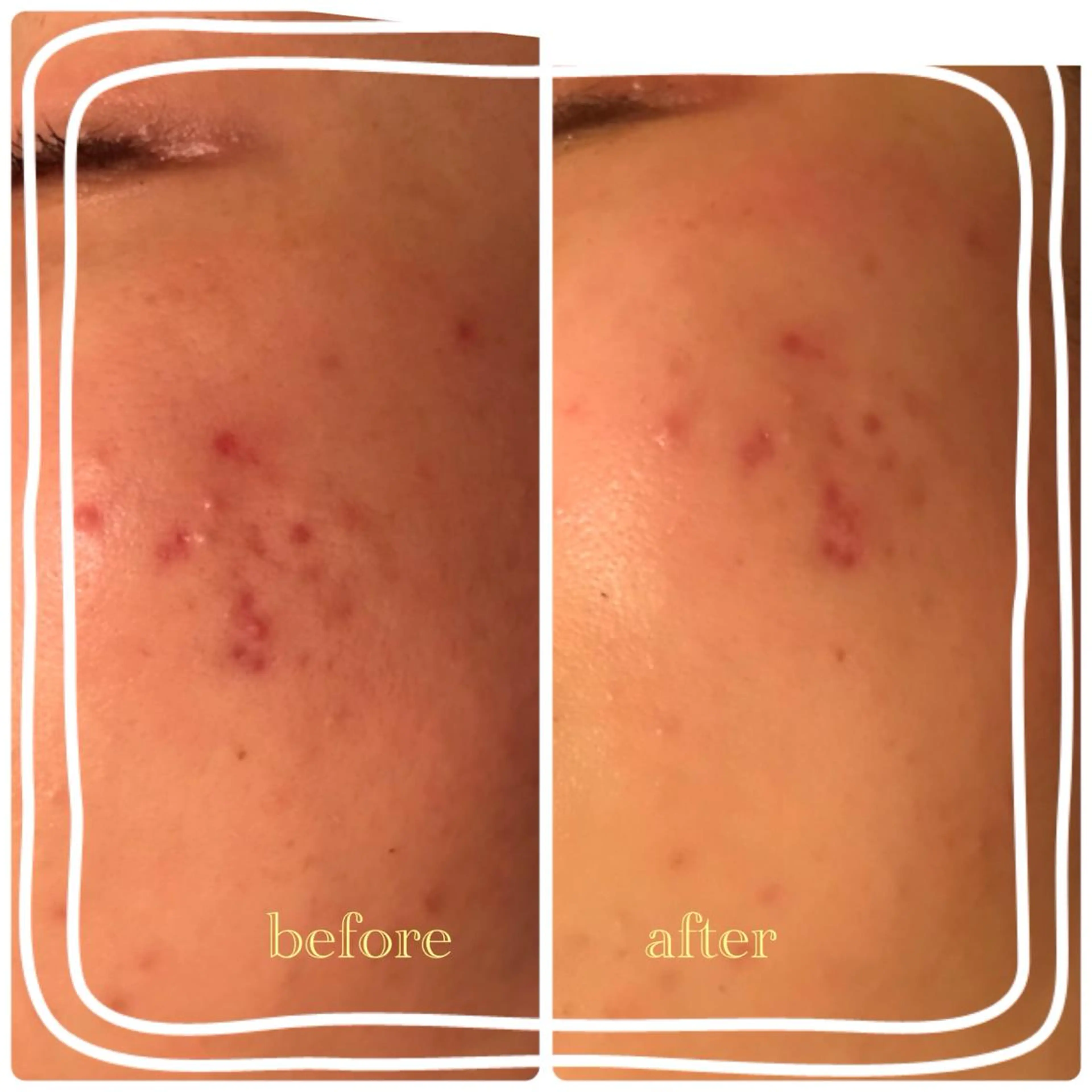 サロンフリーム リンパマッサージのエステ・リラクイメージ