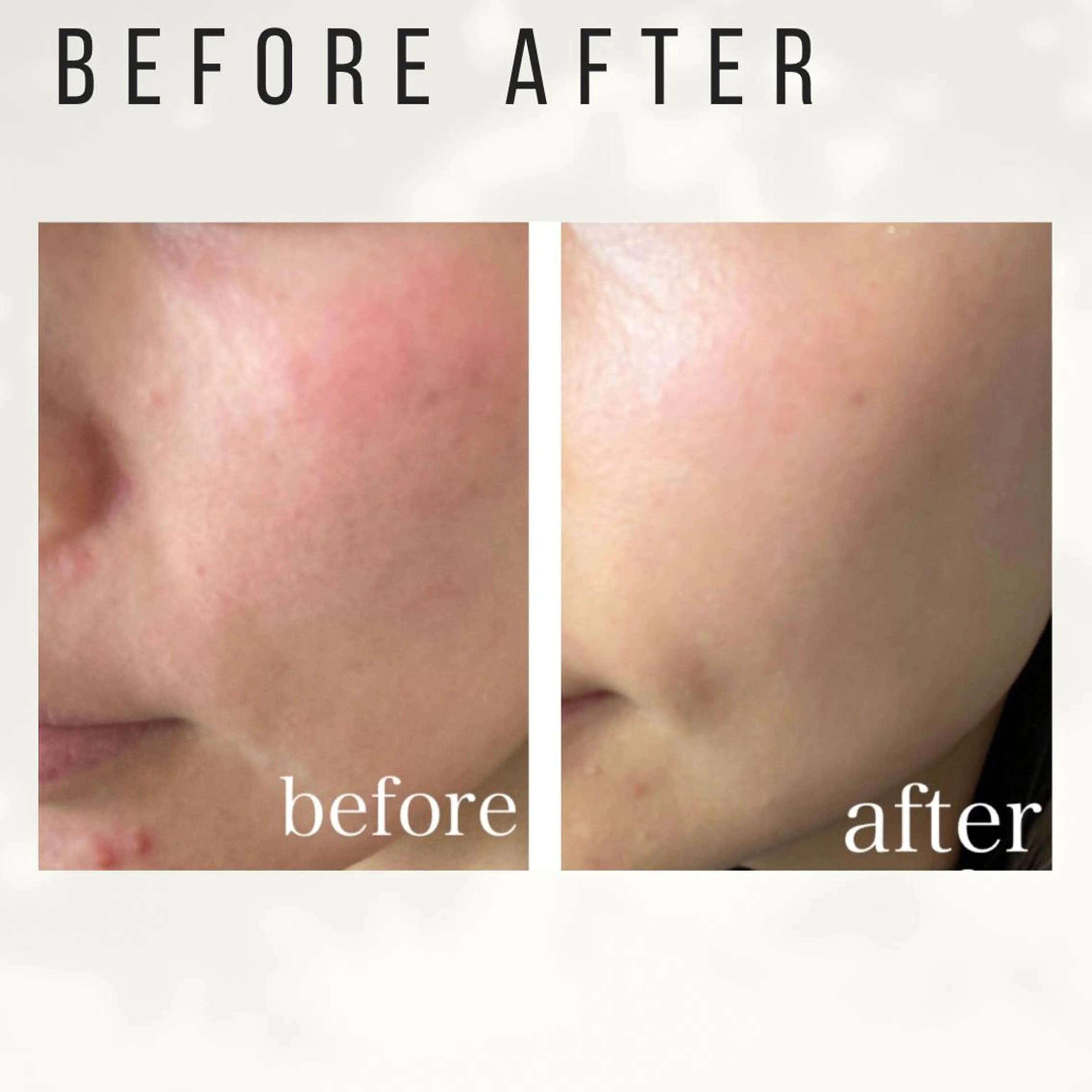 大人女性のための 肌管理サロン　ハピーのエステ・リラクイメージ