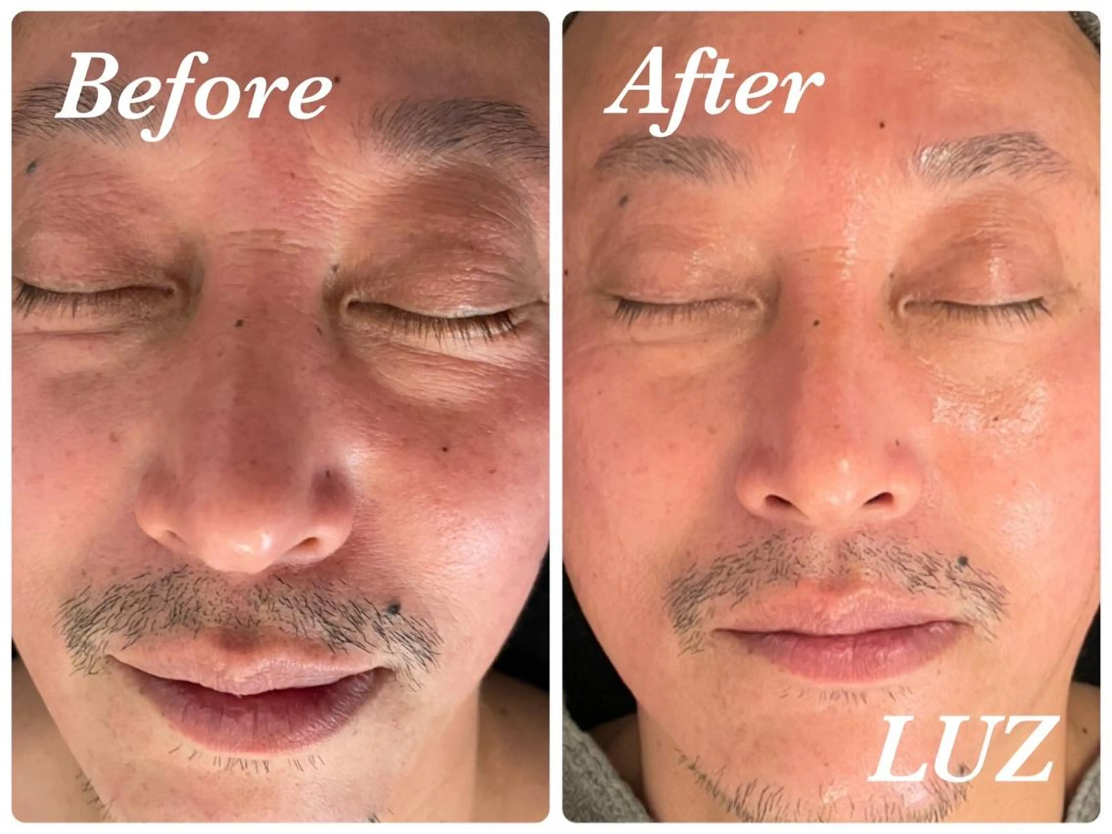 メンズ メンズフェイシャル アイブロウ・ルースのエステ・リラクイメージ