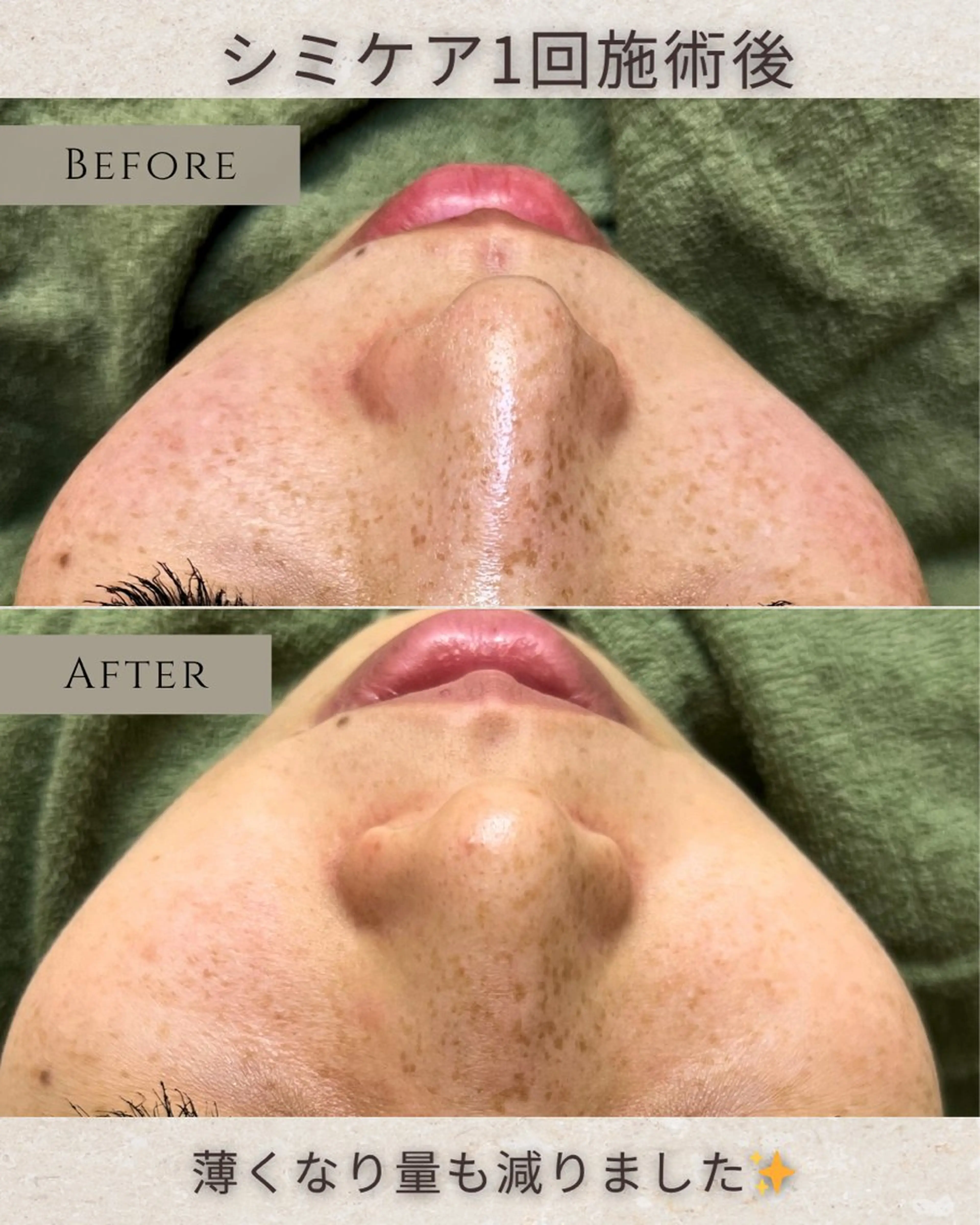 稲垣 優のエステ・リラクイメージ