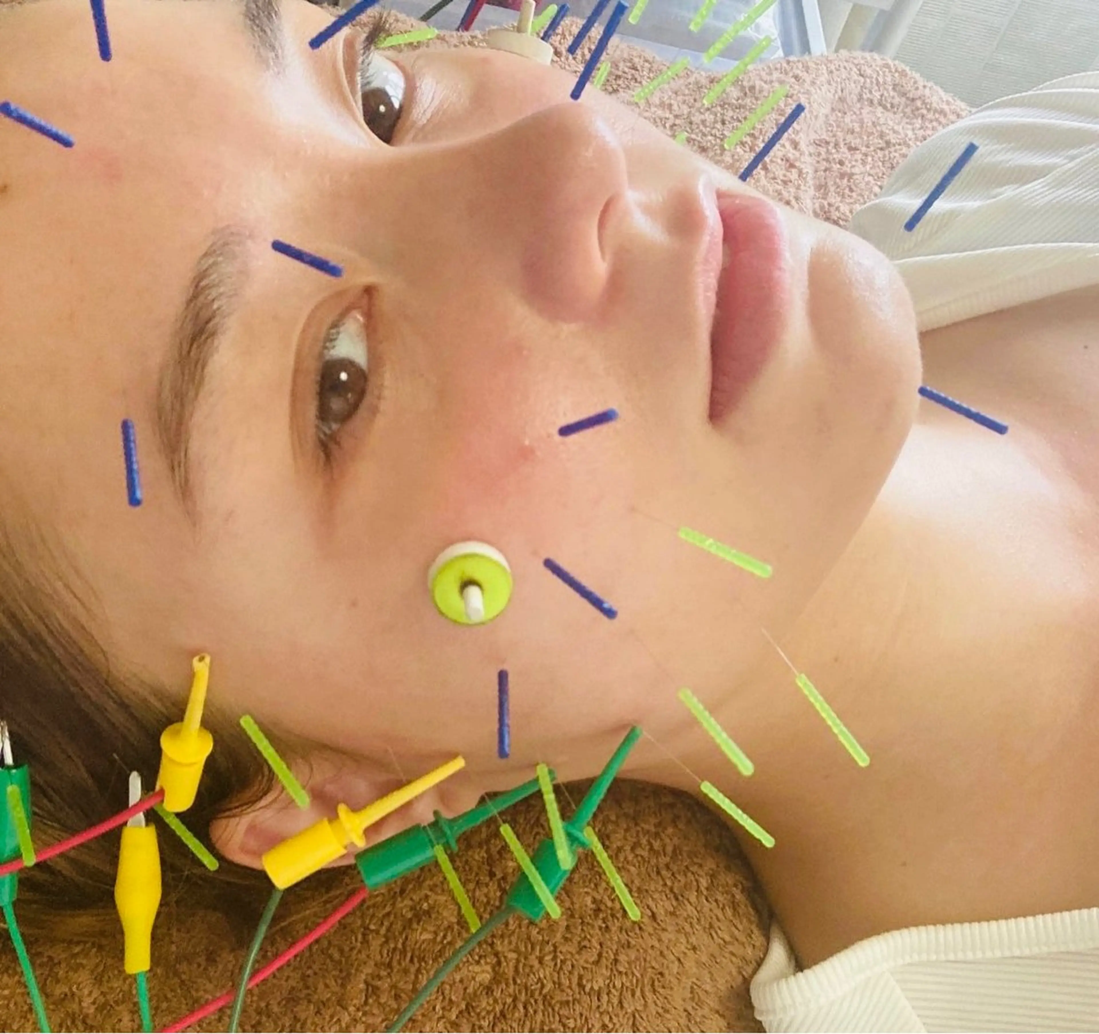 美容鍼灸サロン mahoroba院長のエステ・リラクイメージ