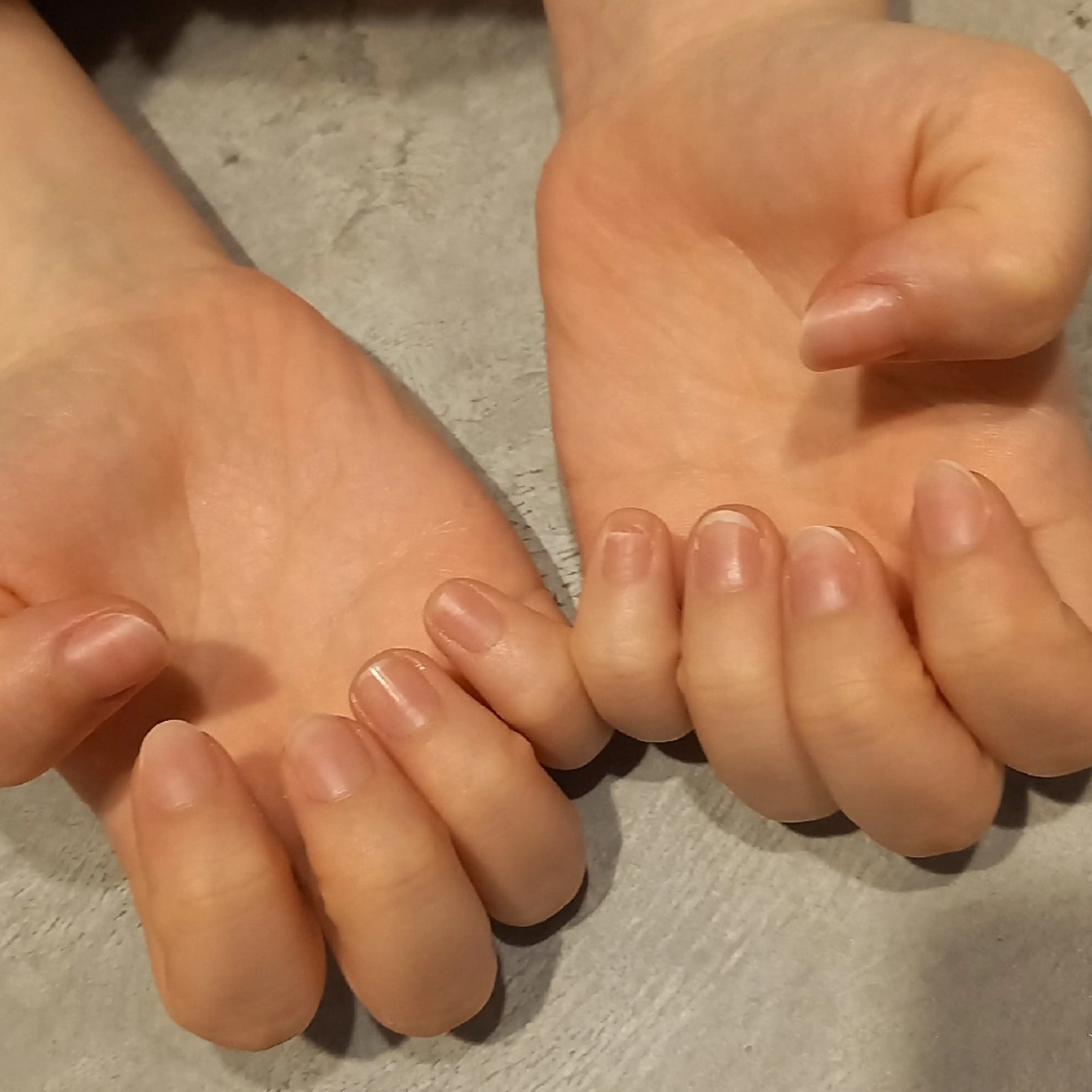 ケアのみの写真