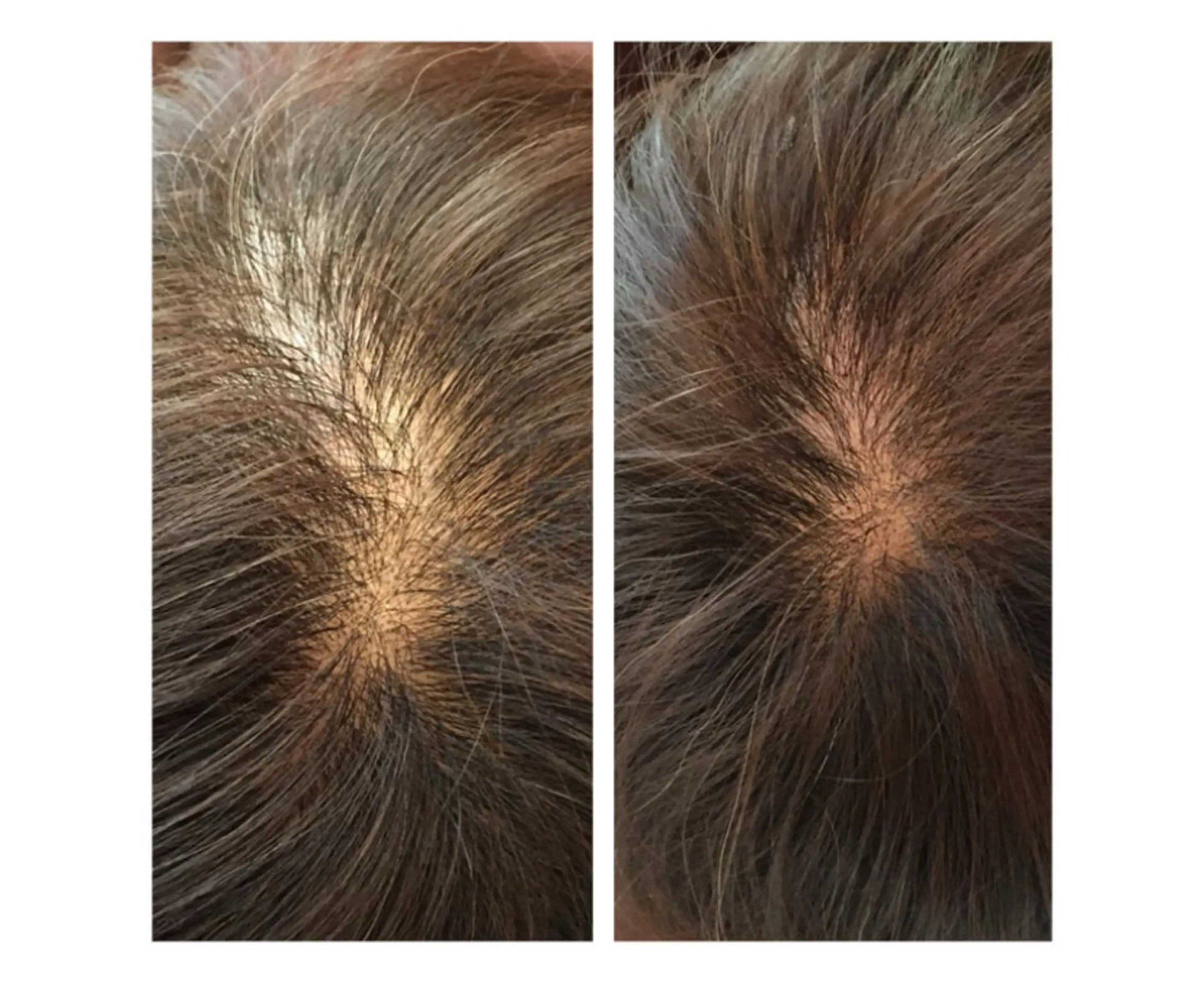 育毛ヘッドスパ&300本増毛エクステンション☆気軽に増毛体験☆の写真