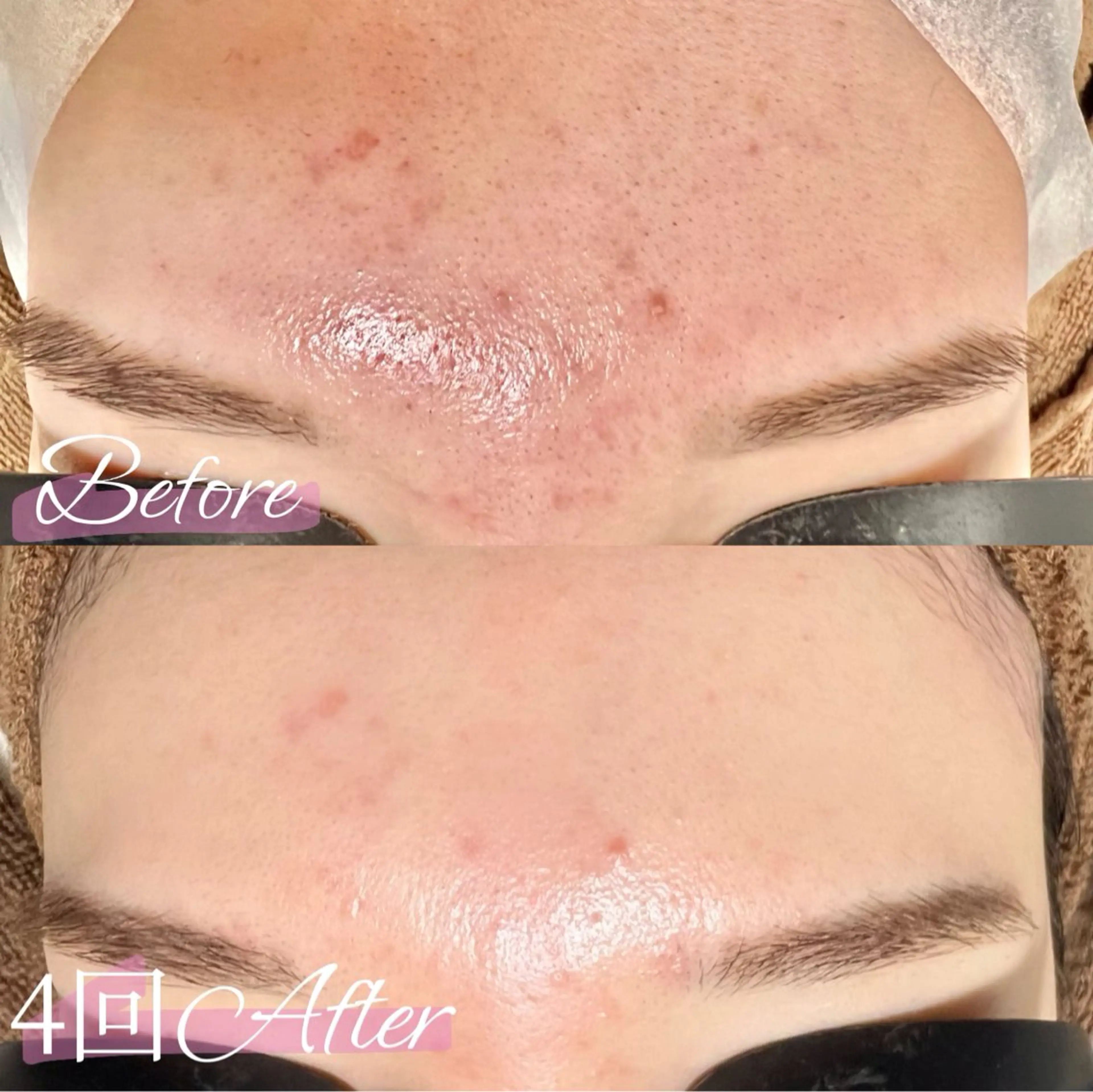 エステ 都度払い脱毛 BARNEYのエステ・リラクイメージ