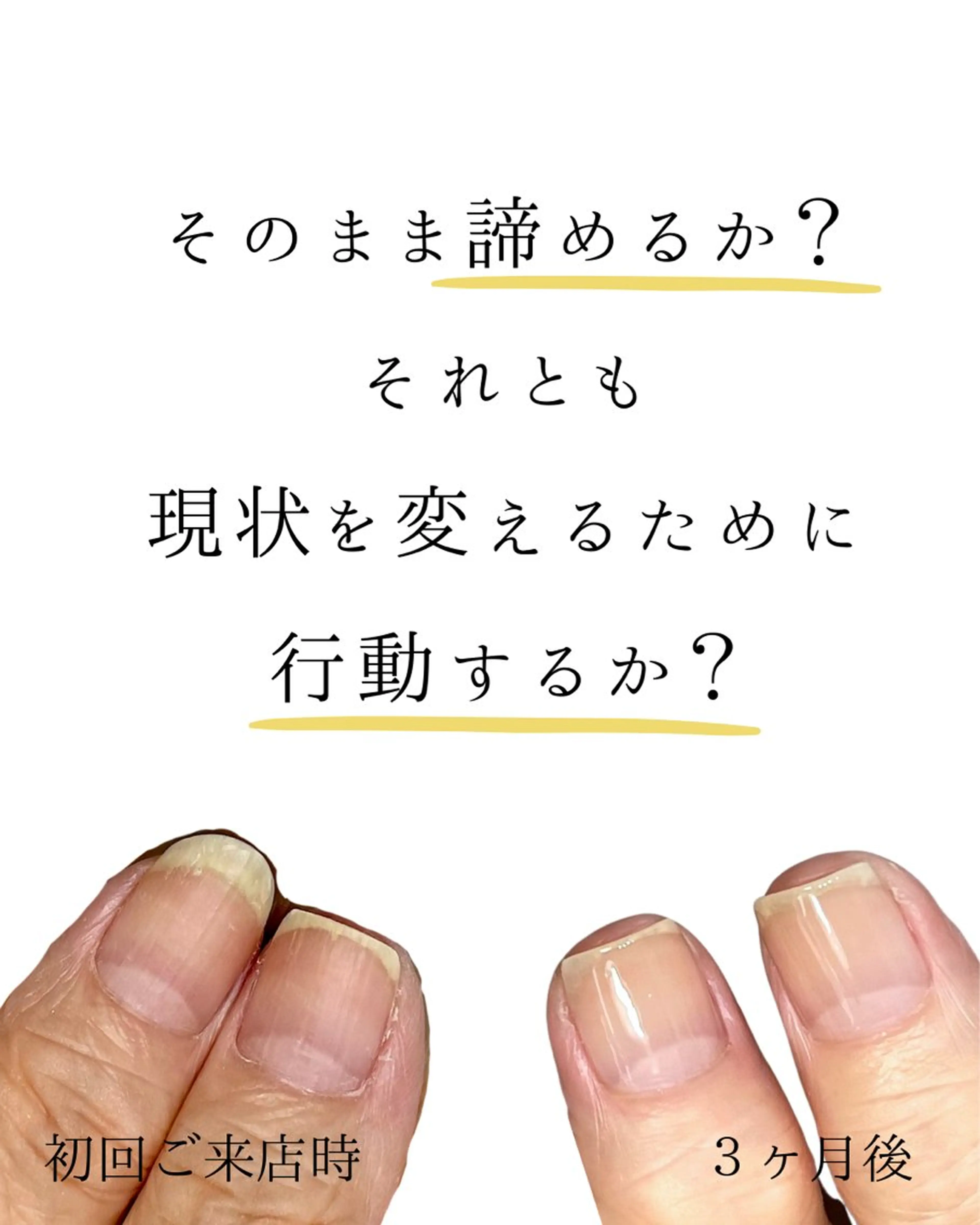 ネイル Aim* 深爪自爪育成専門店のネイルデザイン